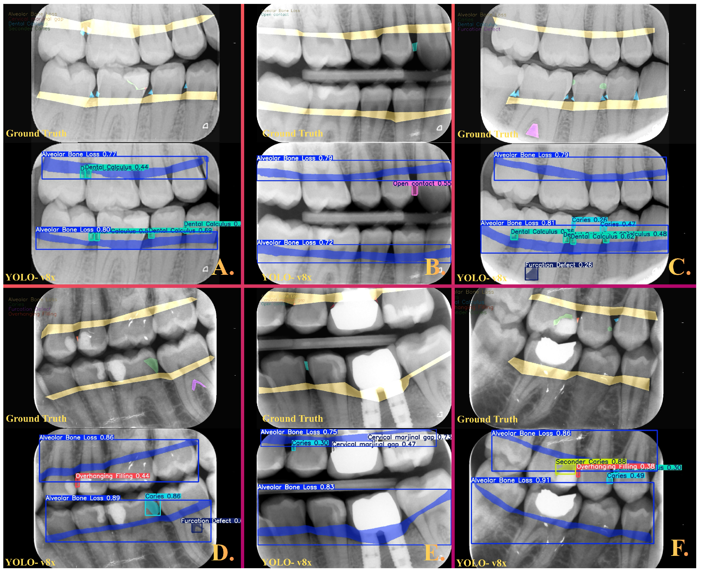 Diagnostics 16 00322 g002 Diagnostics 16 00322 g002