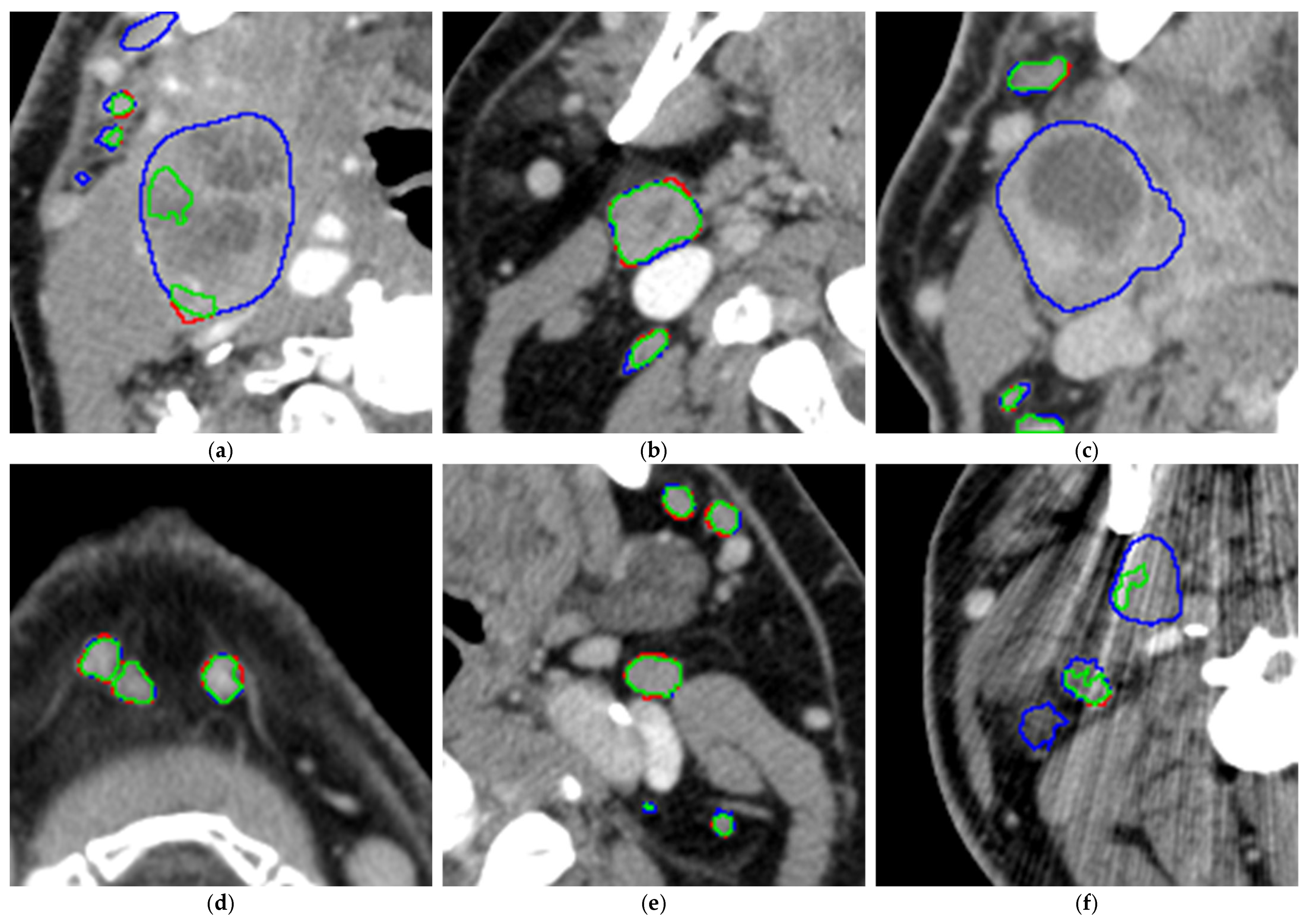 Diagnostics 16 00355 g006