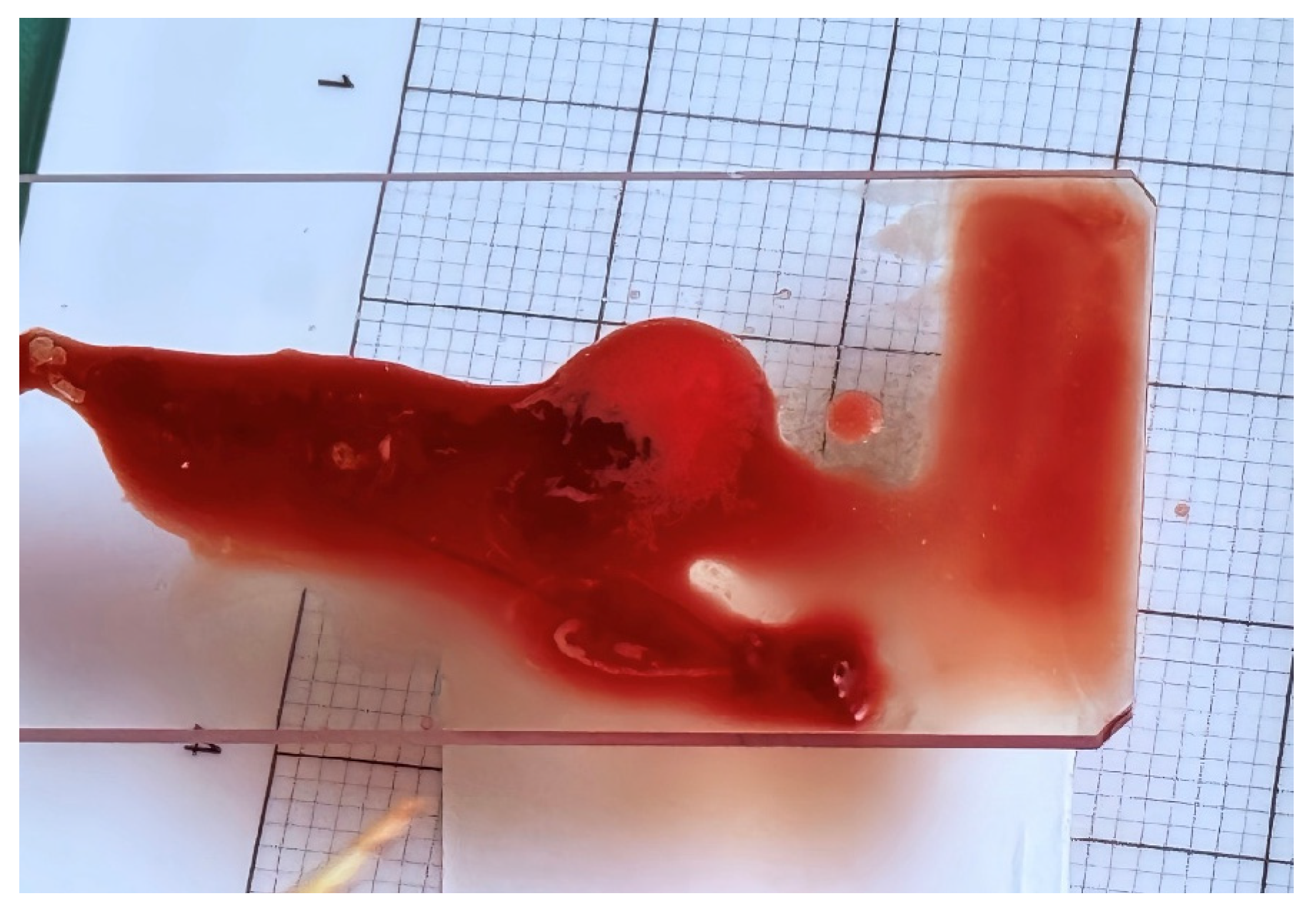 Diagnostics 16 00397 g002 Diagnostics 16 00397 g002