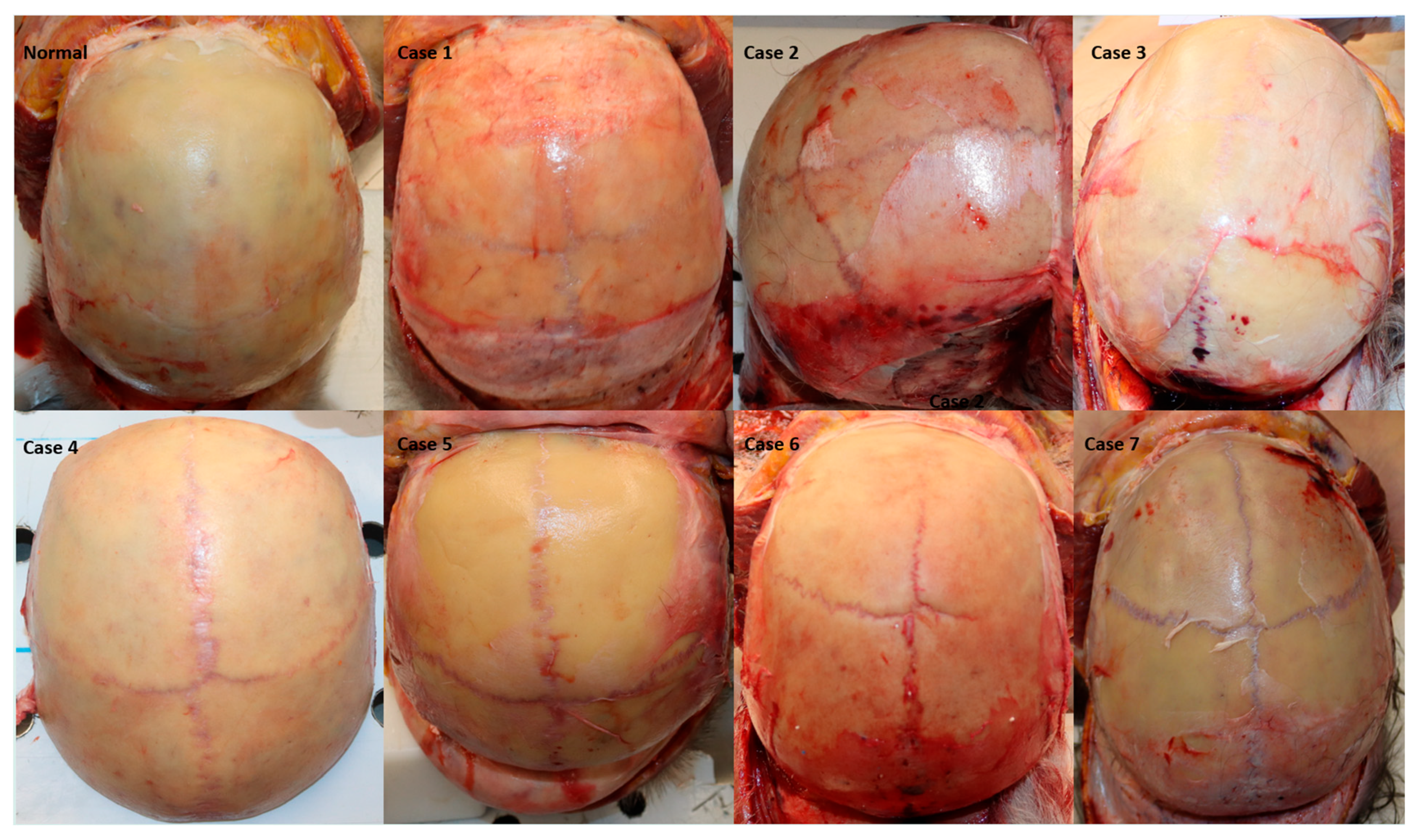 Diagnostics 16 00415 g001 Diagnostics 16 00415 g001