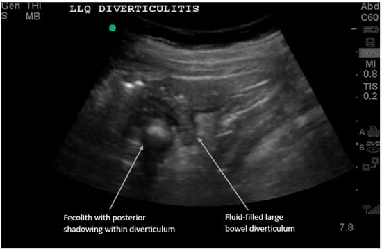 Diagnostics 16 00418 g002