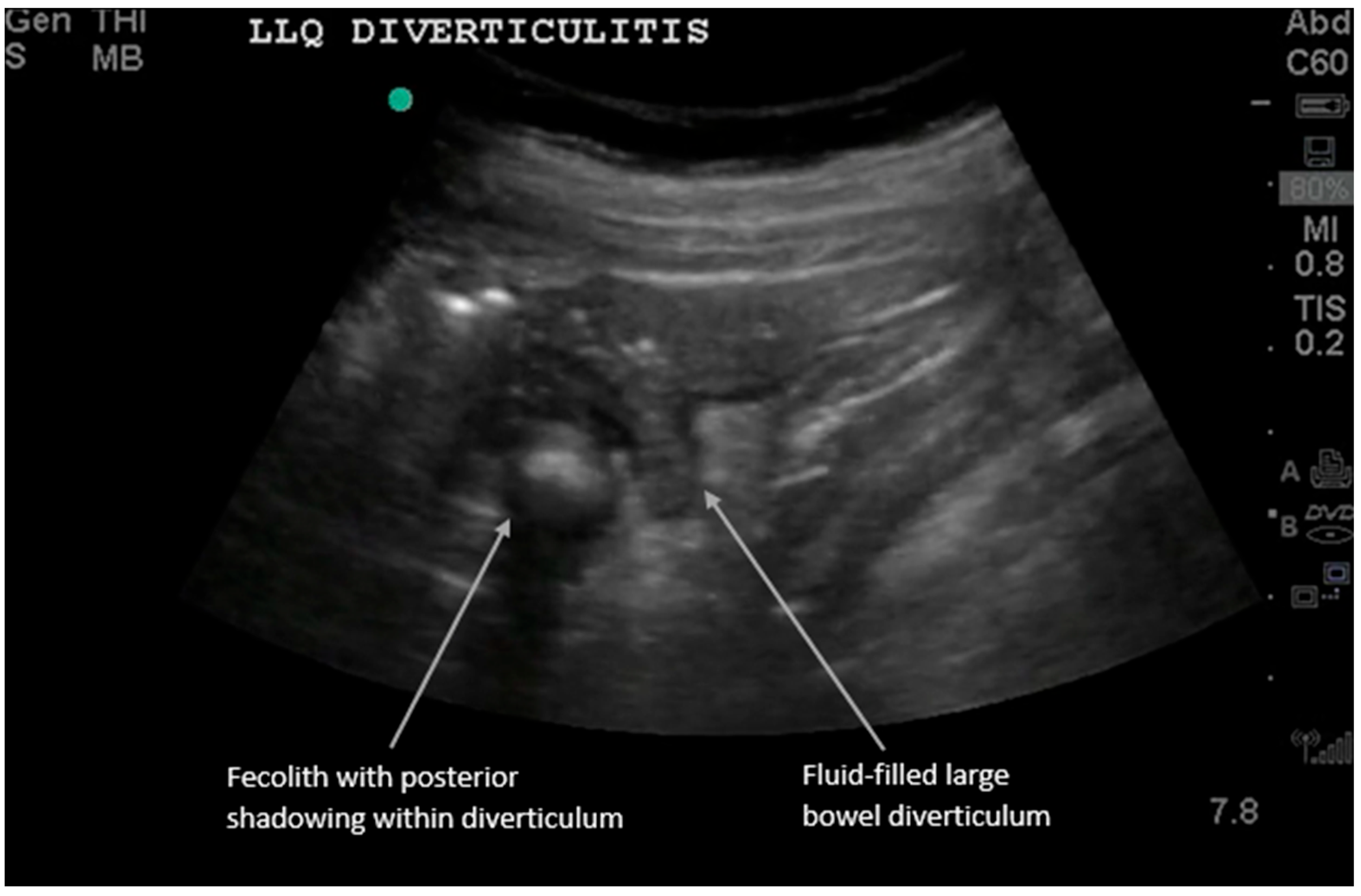 Diagnostics 16 00418 g002 Diagnostics 16 00418 g002