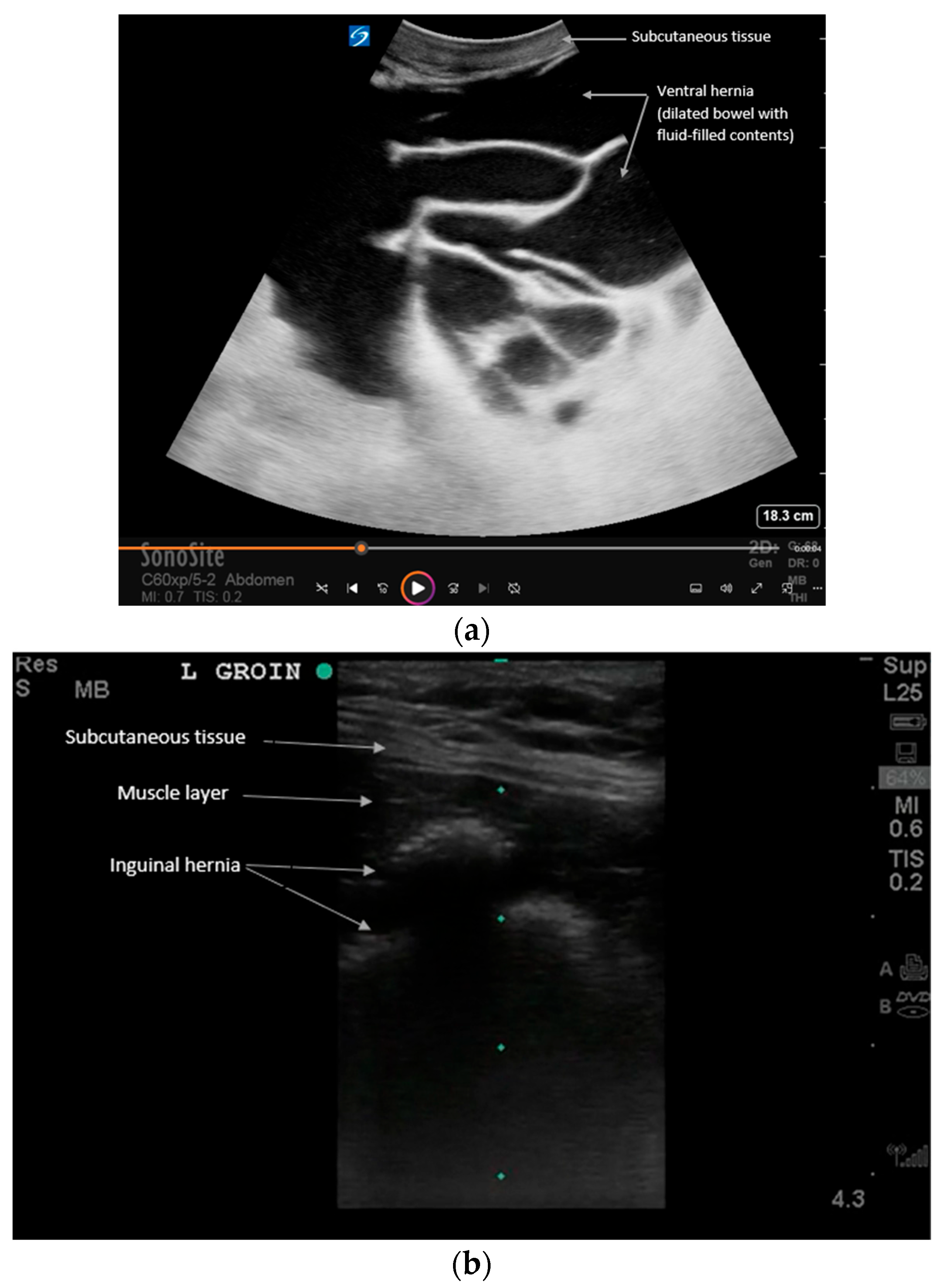 Diagnostics 16 00418 g003 Diagnostics 16 00418 g003