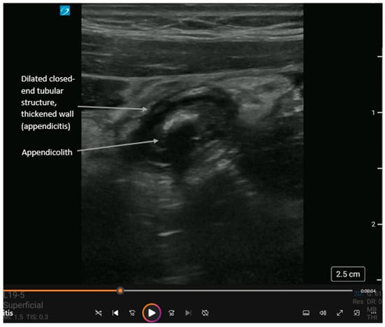 Diagnostics 16 00418 g004