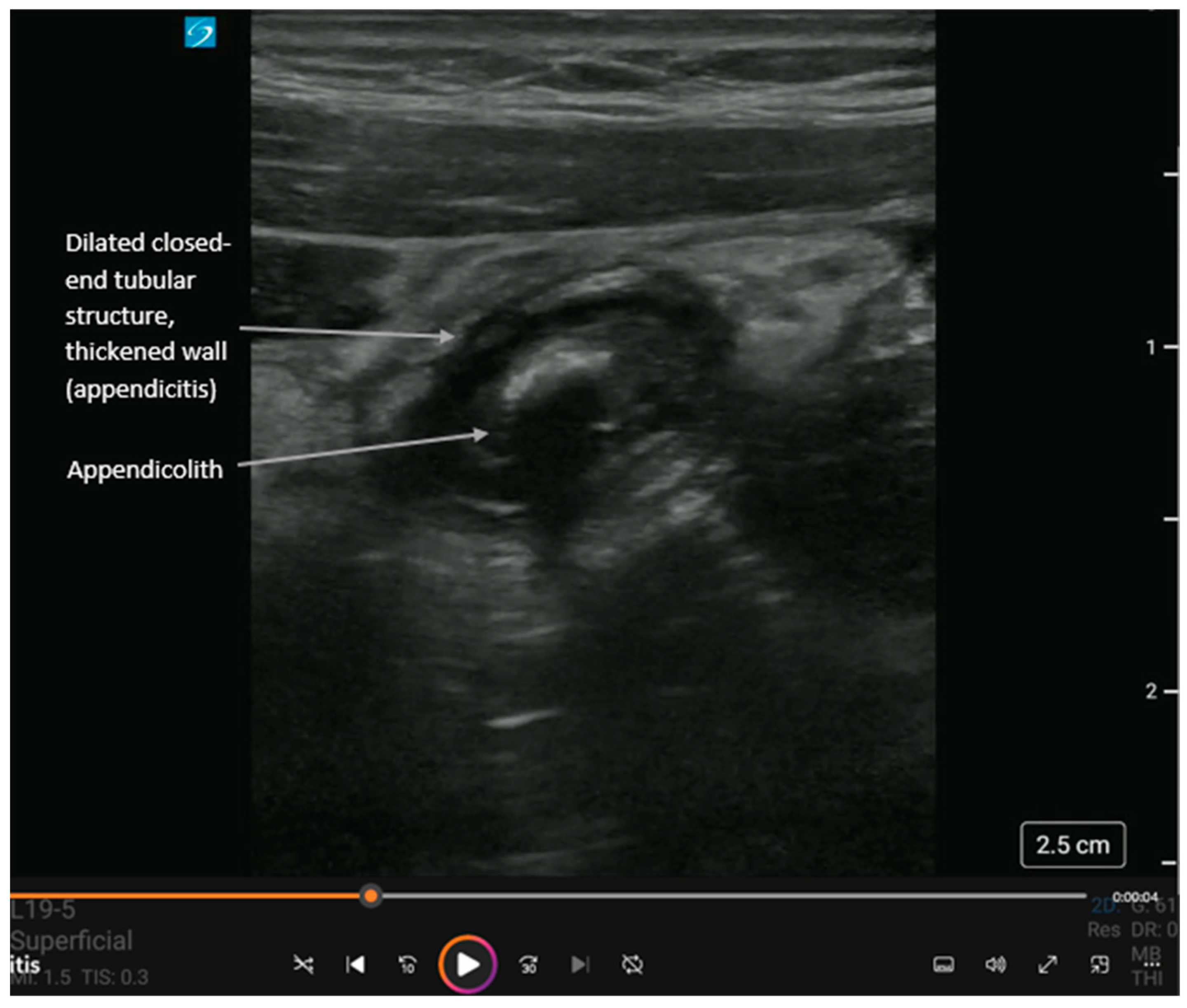 Diagnostics 16 00418 g004 Diagnostics 16 00418 g004