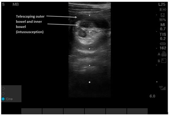 Diagnostics 16 00418 g005