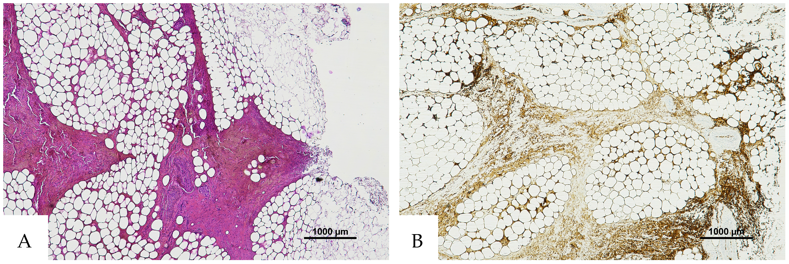 Diagnostics 16 00419 g005 Diagnostics 16 00419 g005