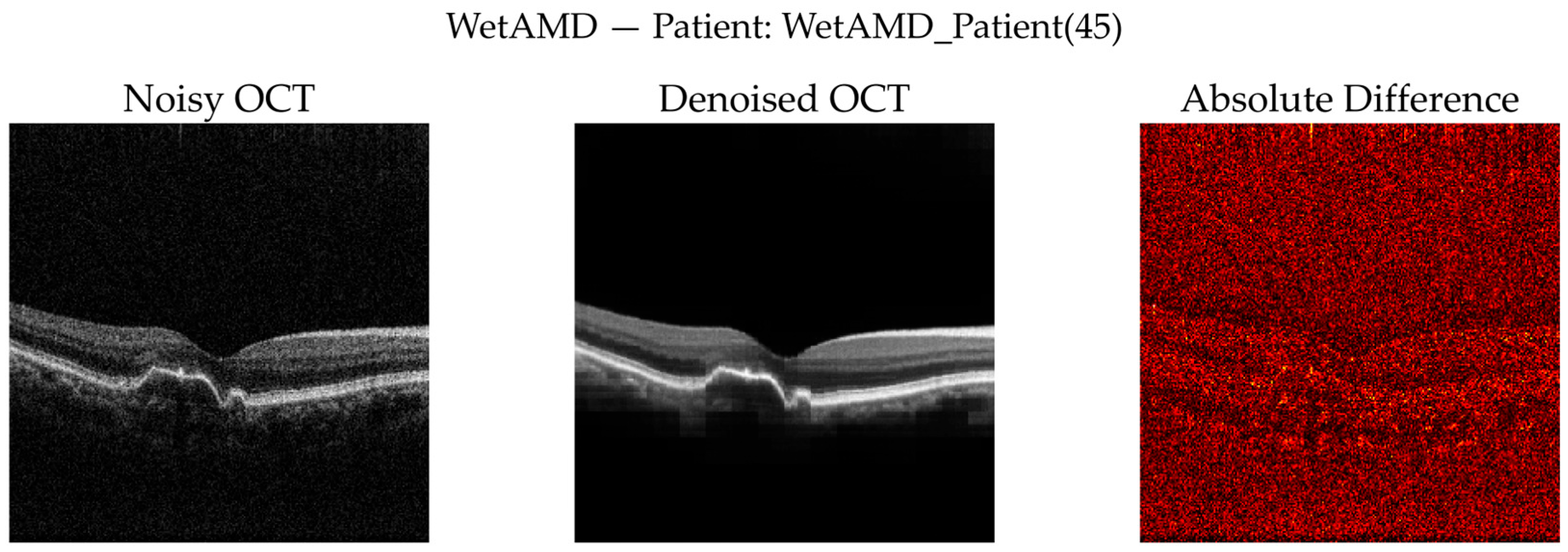 Diagnostics 16 00420 g012 Diagnostics 16 00420 g012