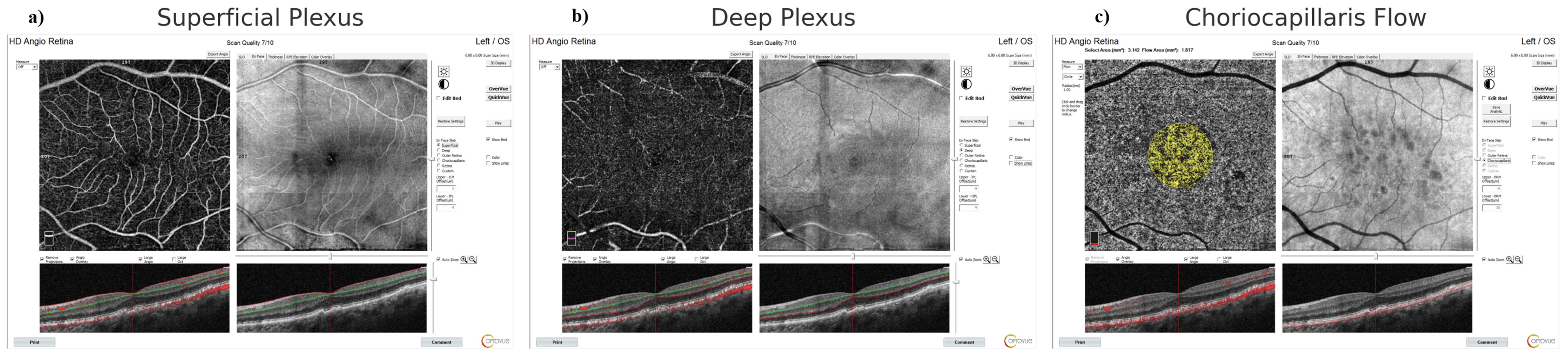 Diagnostics 16 00422 g001 Diagnostics 16 00422 g001