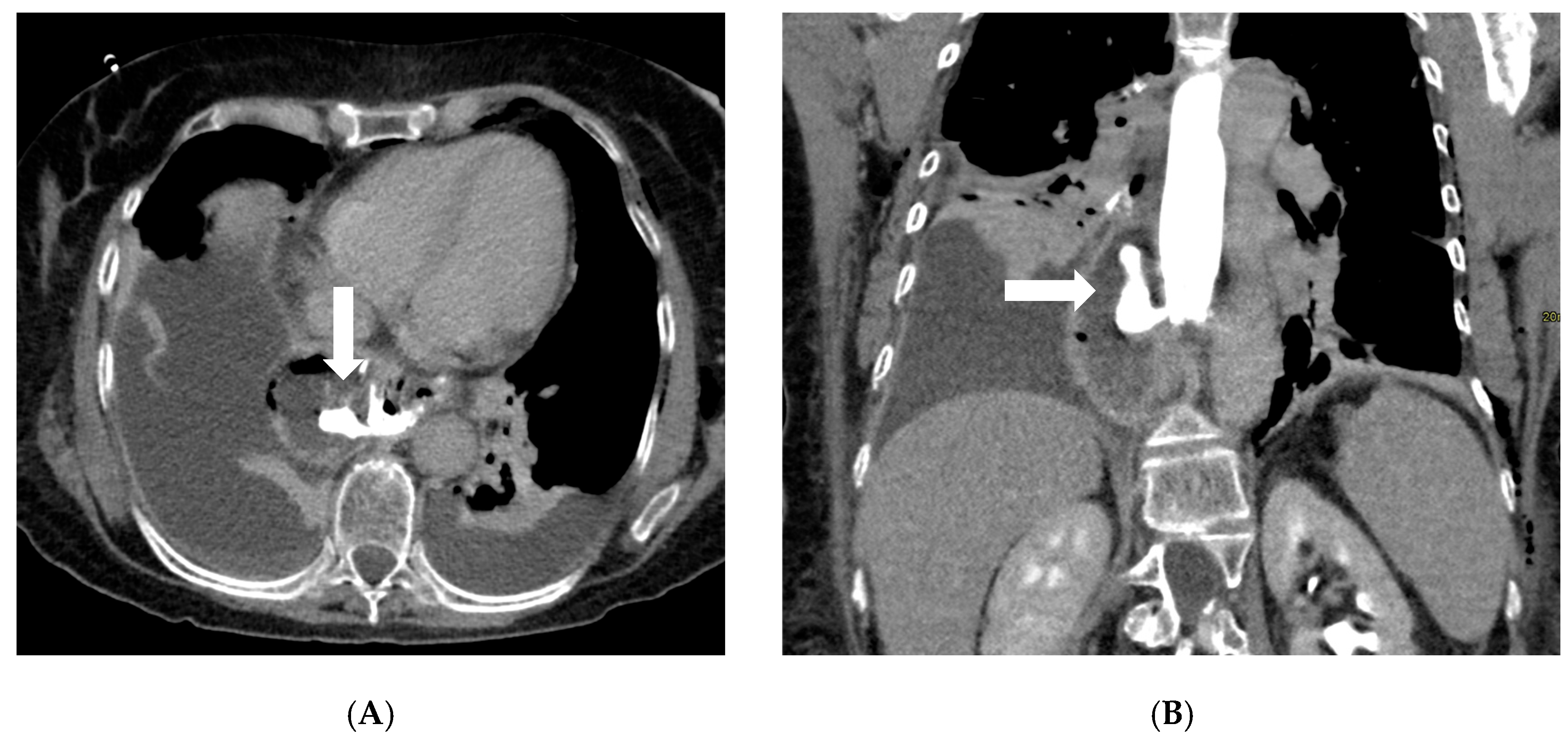Diagnostics 16 00431 g002 Diagnostics 16 00431 g002