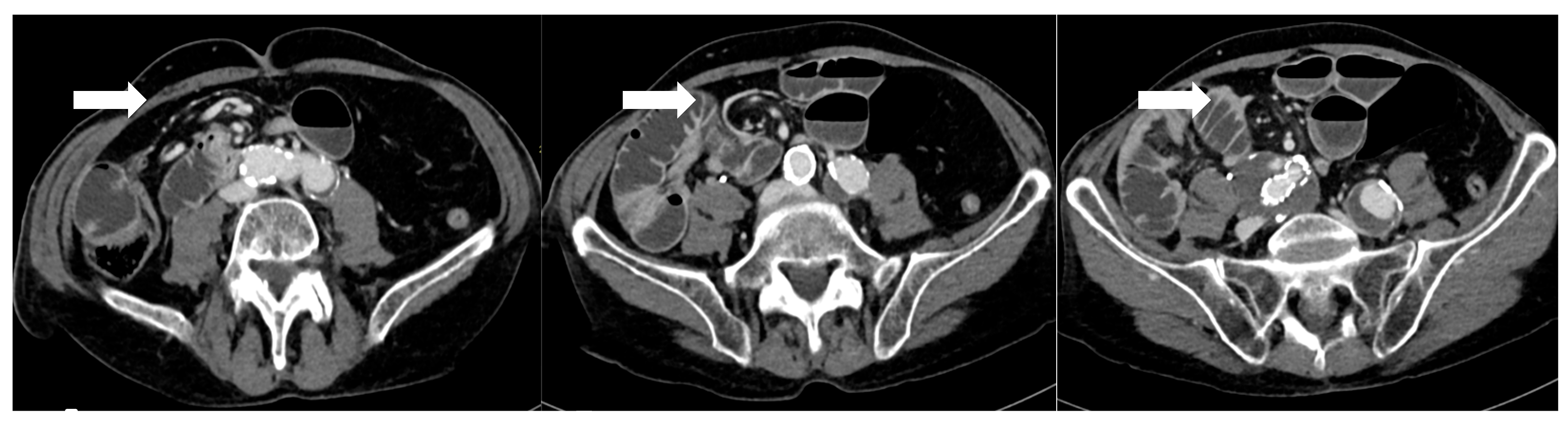 Diagnostics 16 00431 g003 Diagnostics 16 00431 g003
