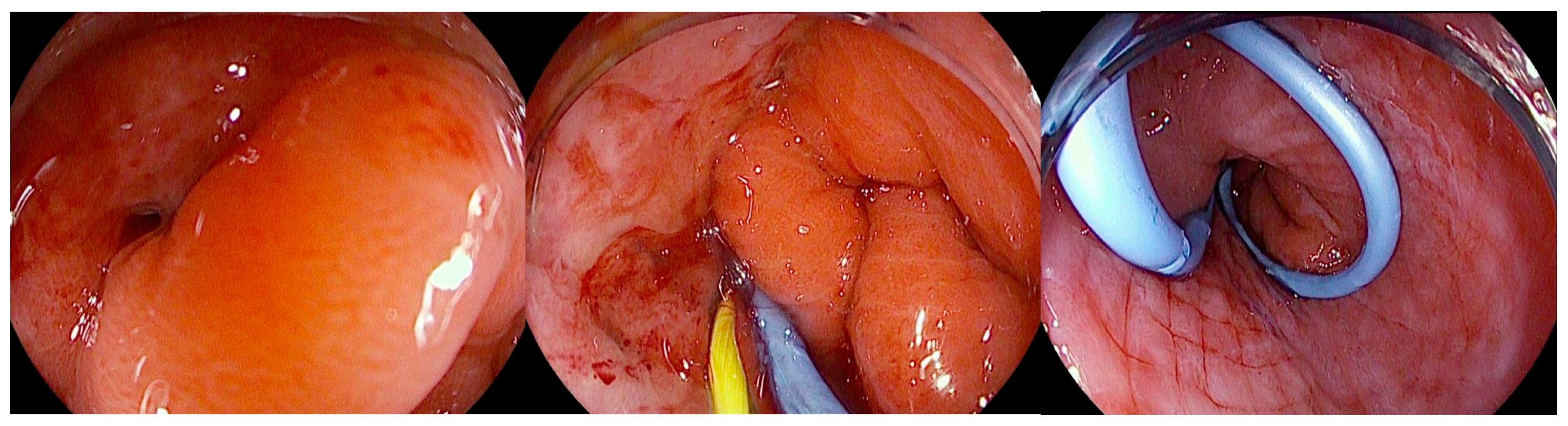 Diagnostics 16 00431 g006 Diagnostics 16 00431 g006