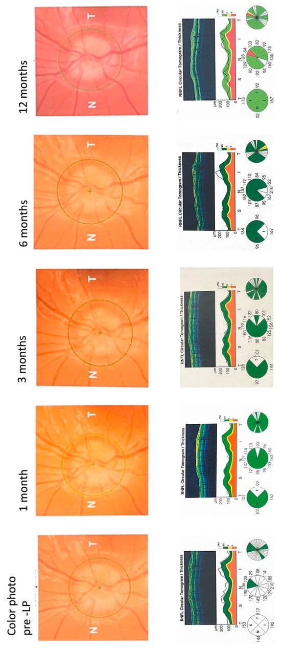 Diagnostics 16 00457 g006