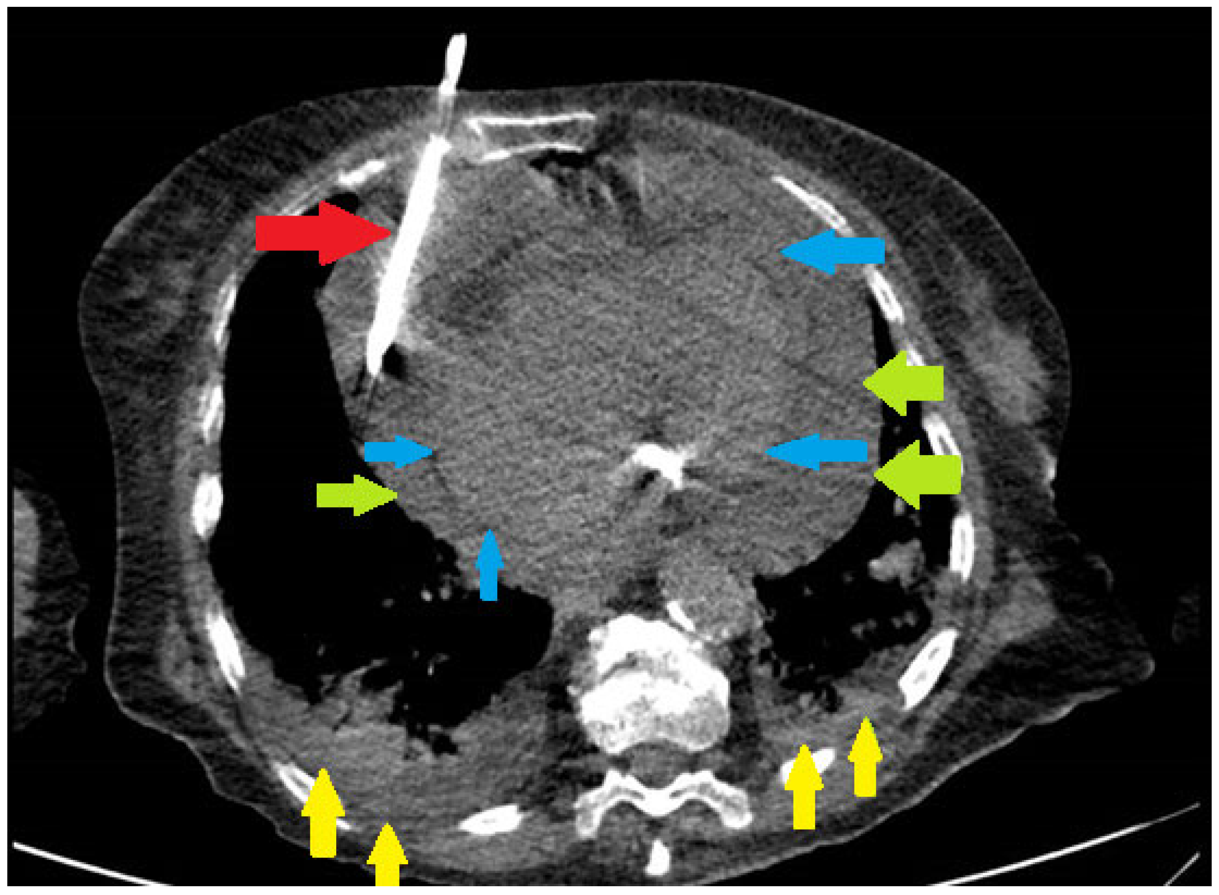 Diagnostics 16 00464 g001 Diagnostics 16 00464 g001