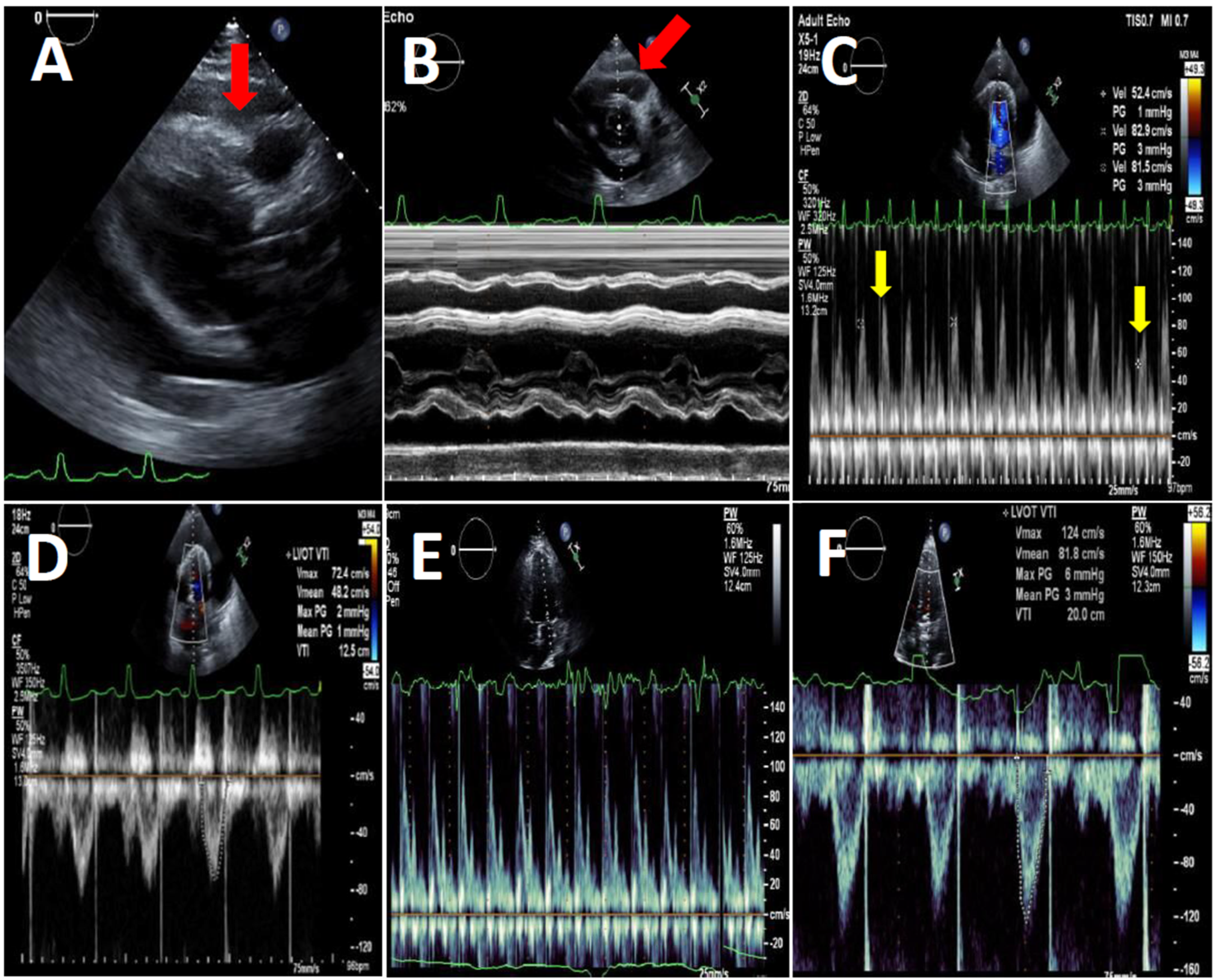 Diagnostics 16 00464 g002 Diagnostics 16 00464 g002