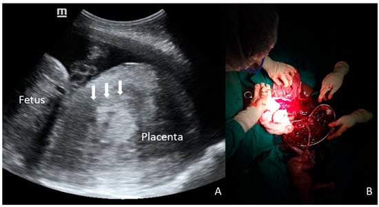 Diagnostics 16 00478 g001