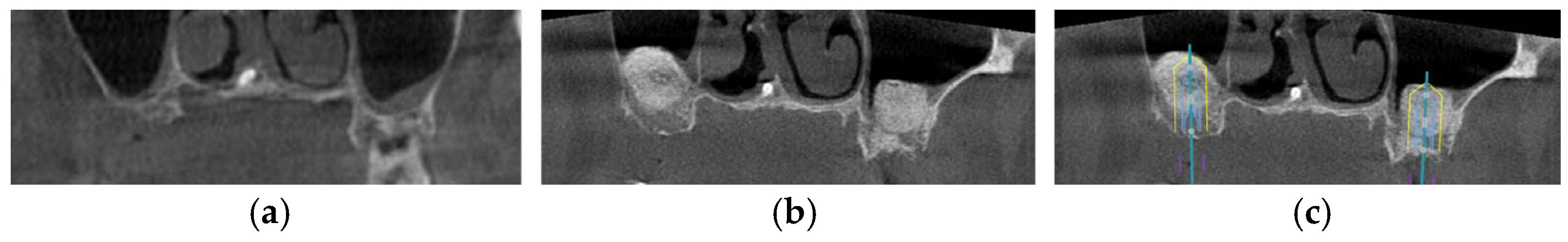 Diagnostics 16 00479 g005