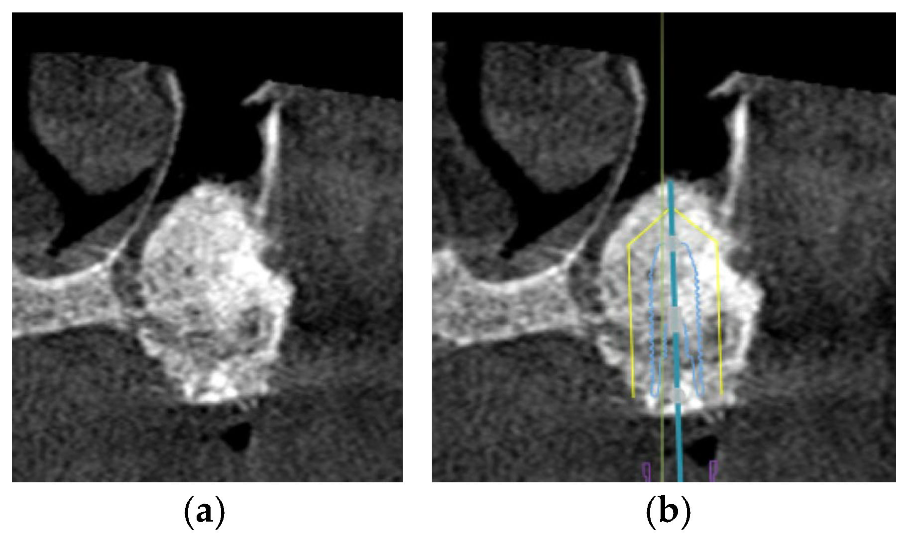 Diagnostics 16 00479 g006