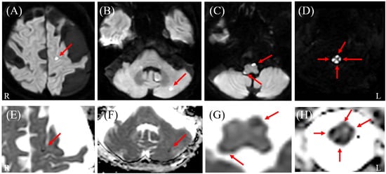 Diagnostics 16 00504 g001