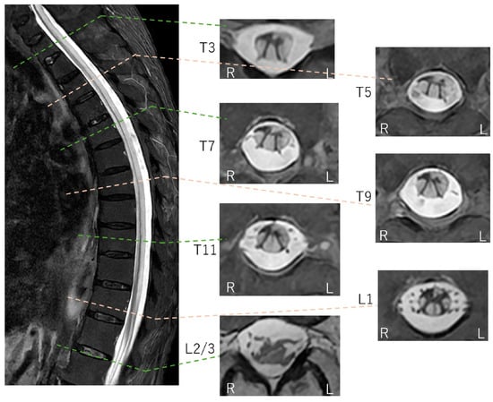 Diagnostics 16 00504 g004