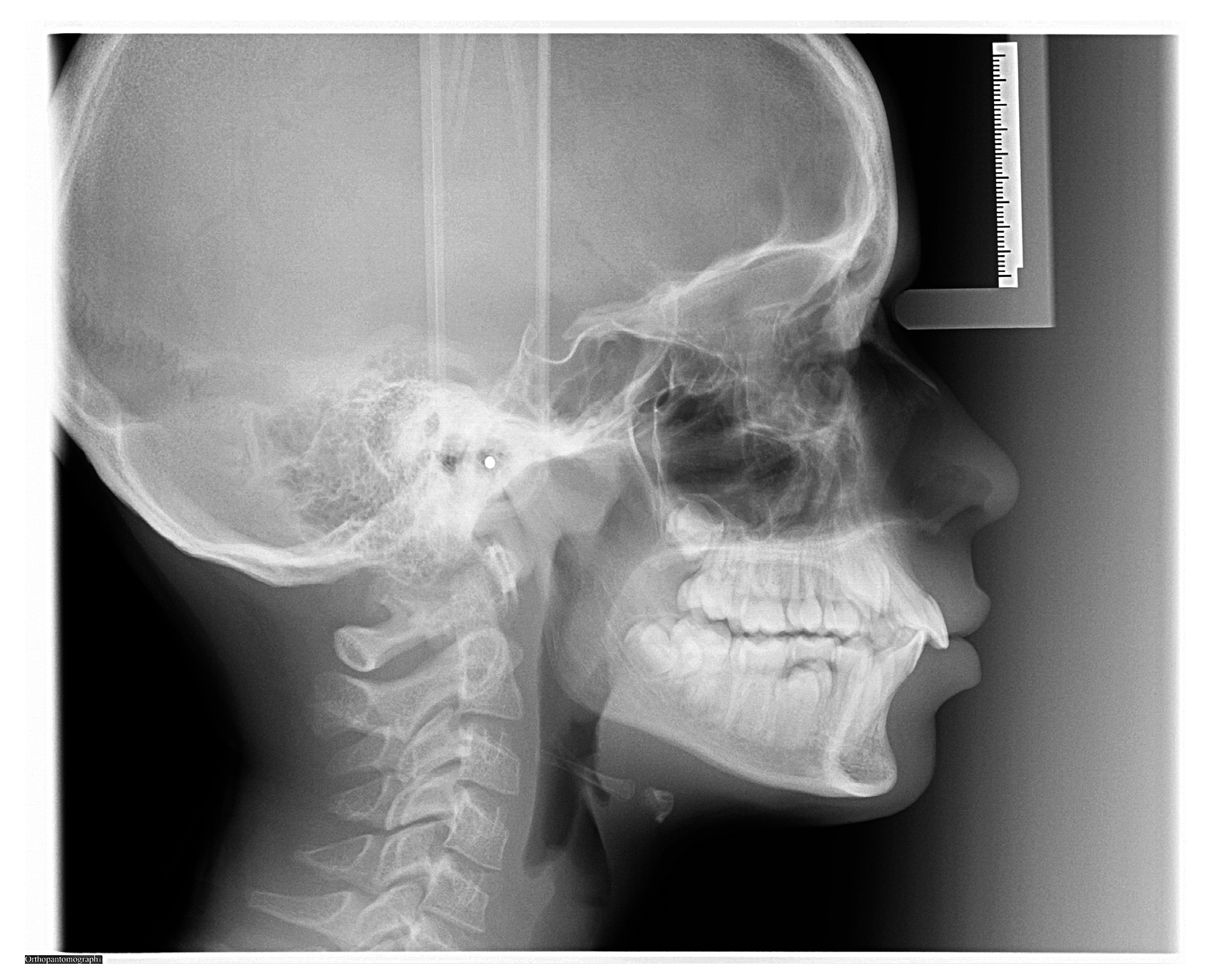 Diagnostics 16 00543 g002 Diagnostics 16 00543 g002