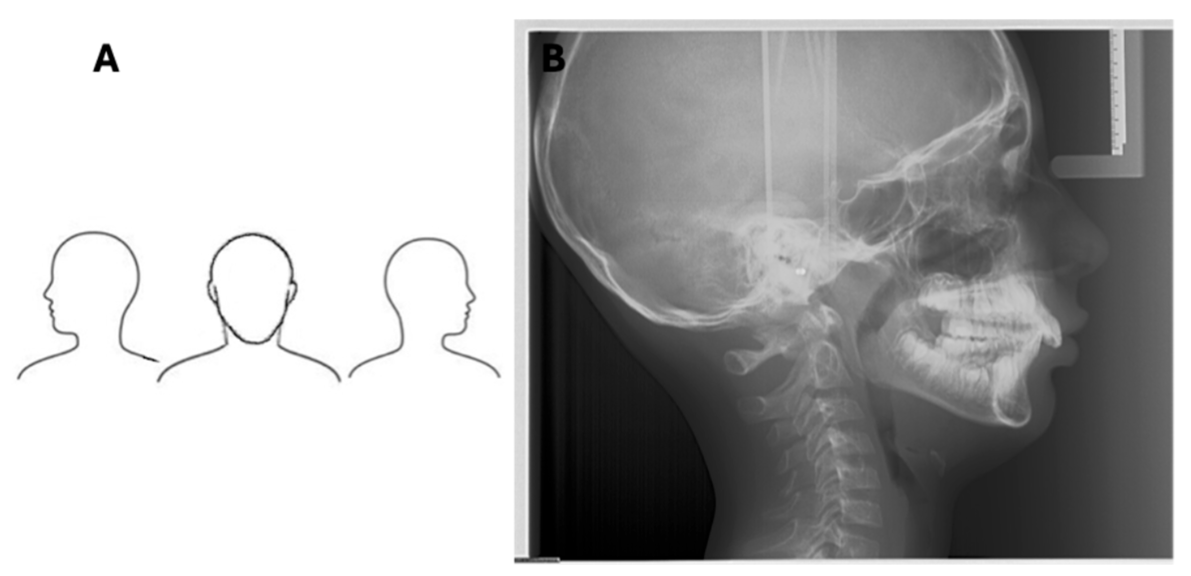 Diagnostics 16 00543 g006 Diagnostics 16 00543 g006