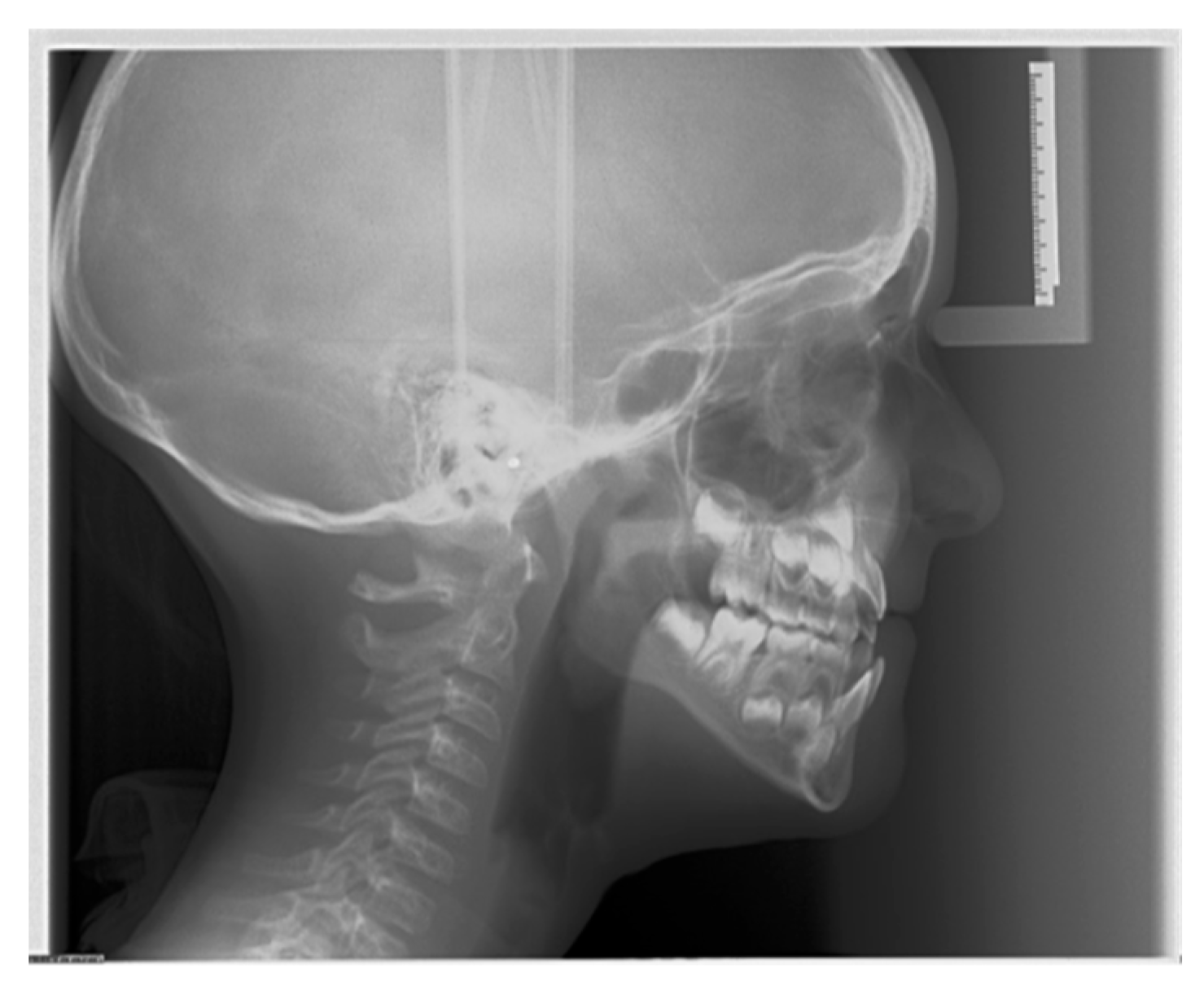 Diagnostics 16 00543 g009 Diagnostics 16 00543 g009