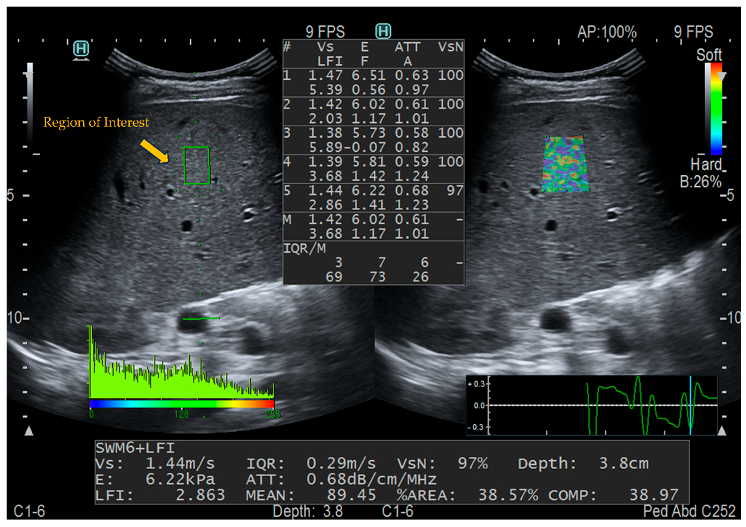 Diagnostics 16 00571 g001 Diagnostics 16 00571 g001