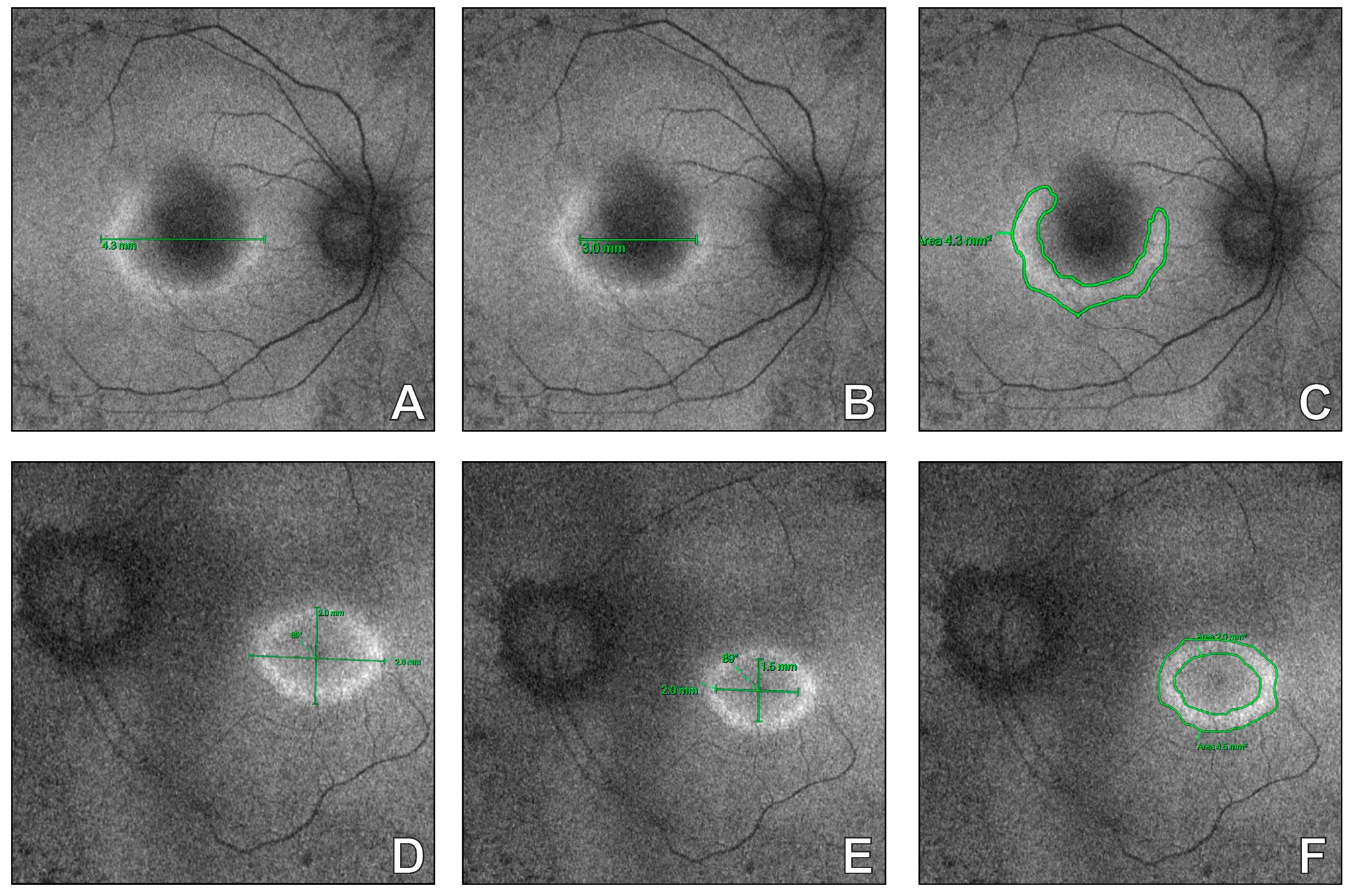 Diagnostics 16 00597 g005