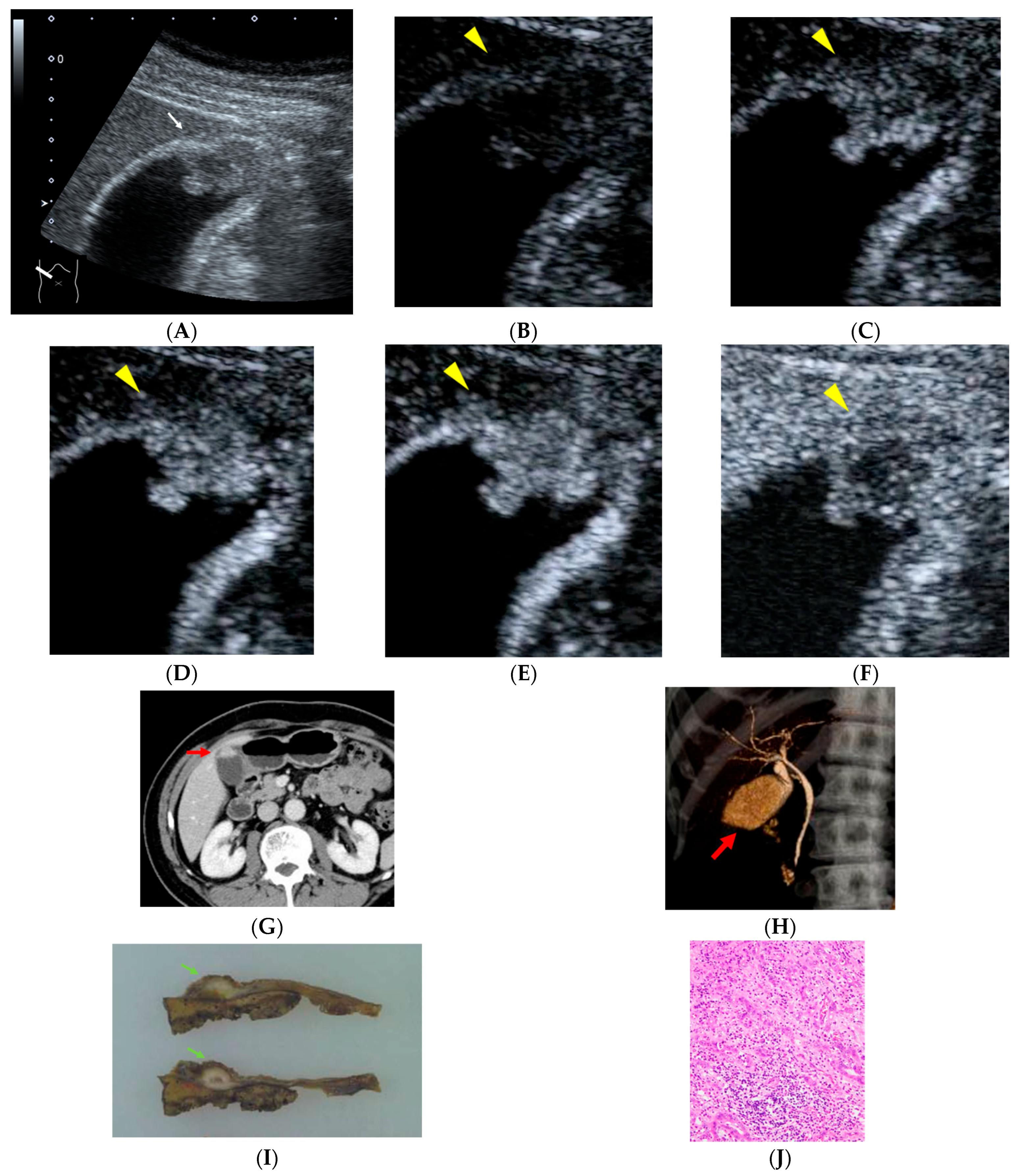 Diagnostics 16 00605 g001