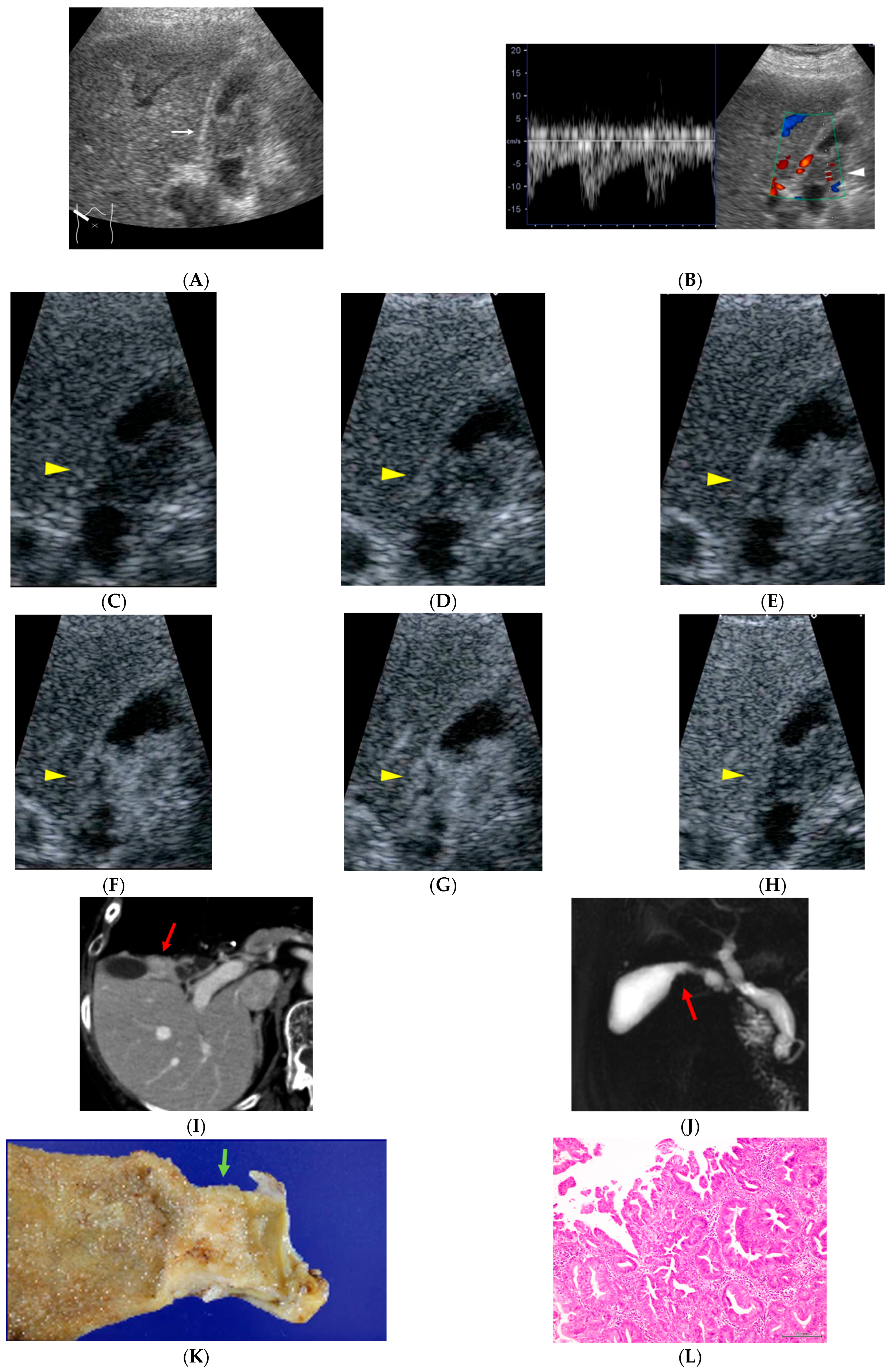 Diagnostics 16 00605 g002