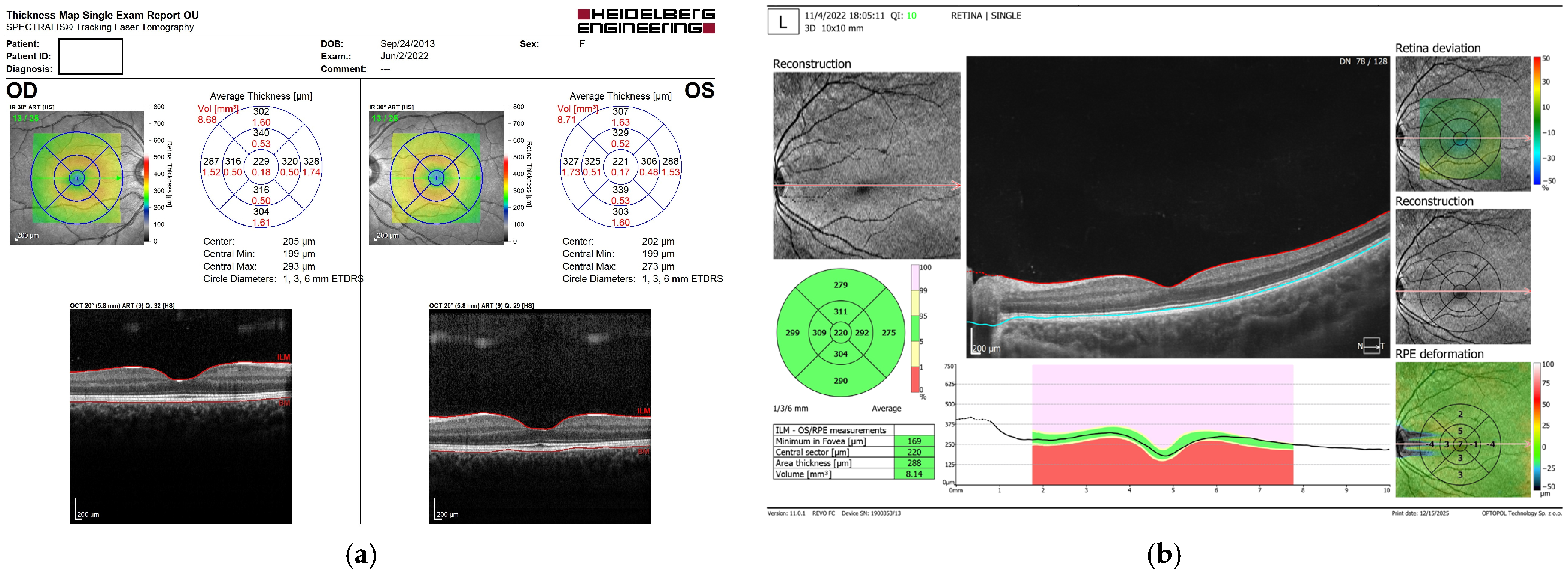 Diagnostics 16 00609 g001 Diagnostics 16 00609 g001