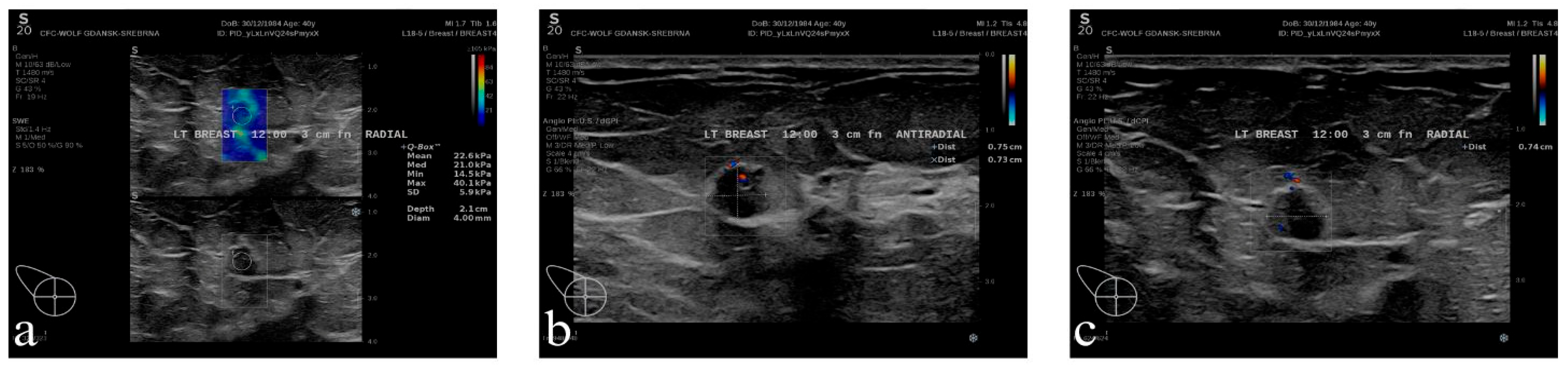 Diagnostics 16 00642 g006 Diagnostics 16 00642 g006