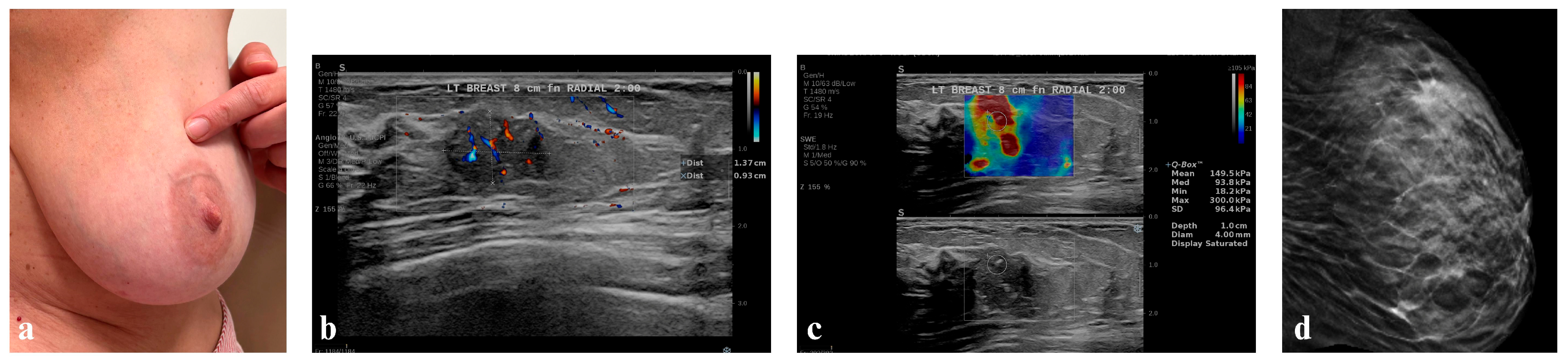 Diagnostics 16 00642 g007 Diagnostics 16 00642 g007