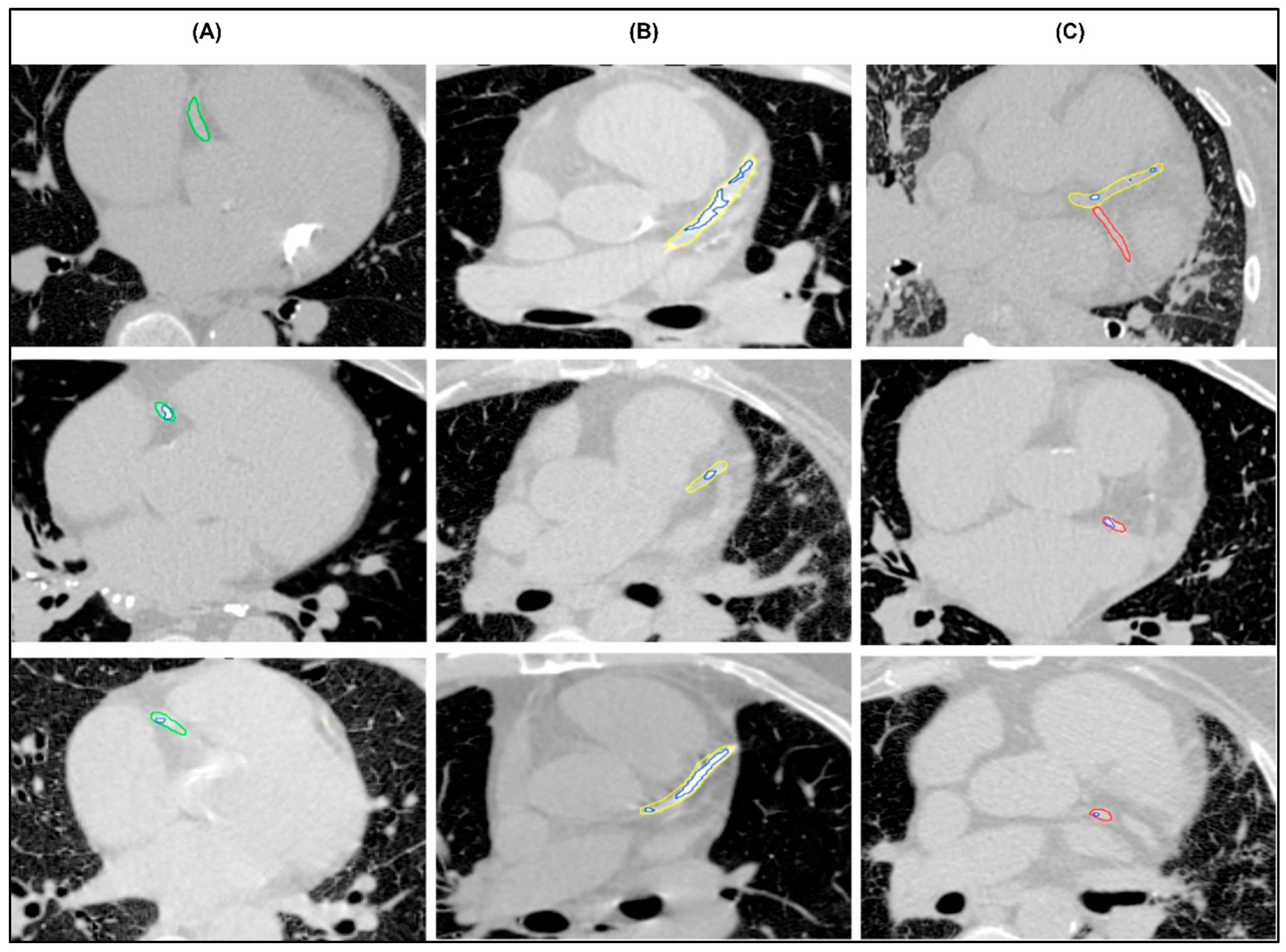 Diagnostics 16 00646 g003