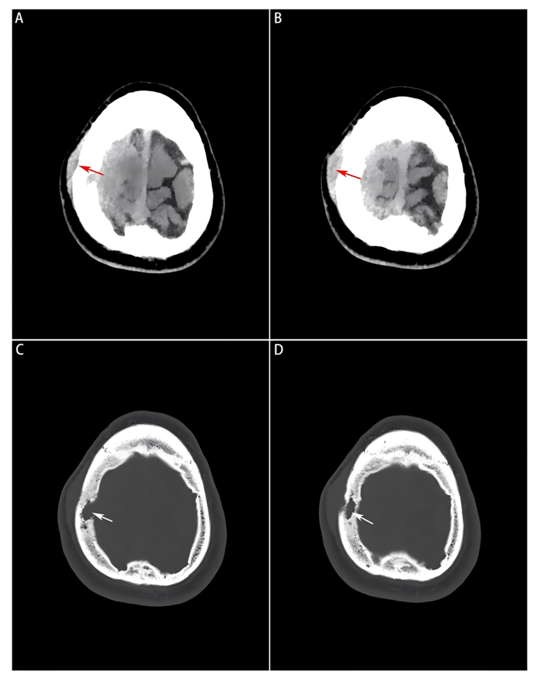Diagnostics 16 00682 g001