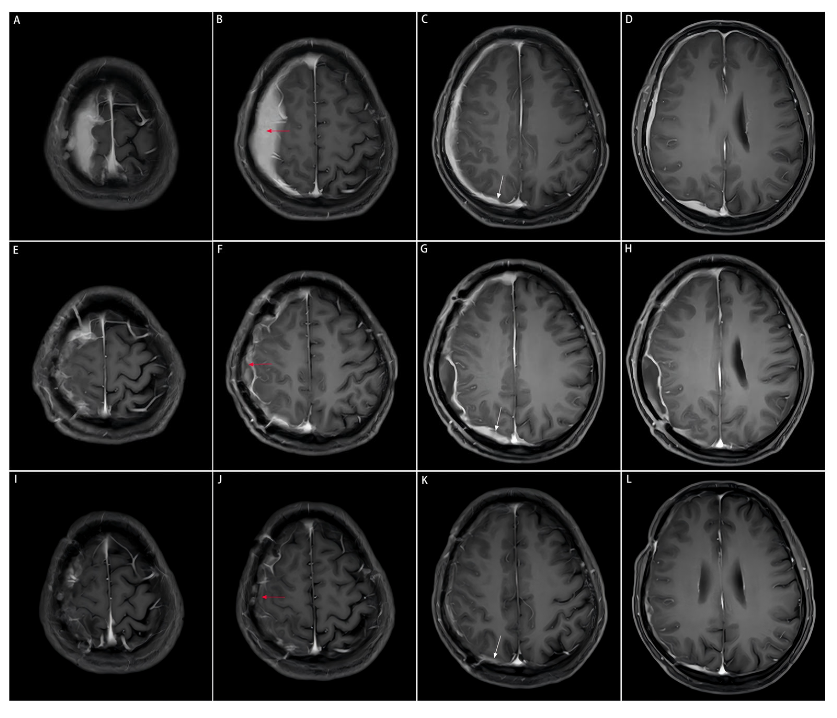 Diagnostics 16 00682 g002