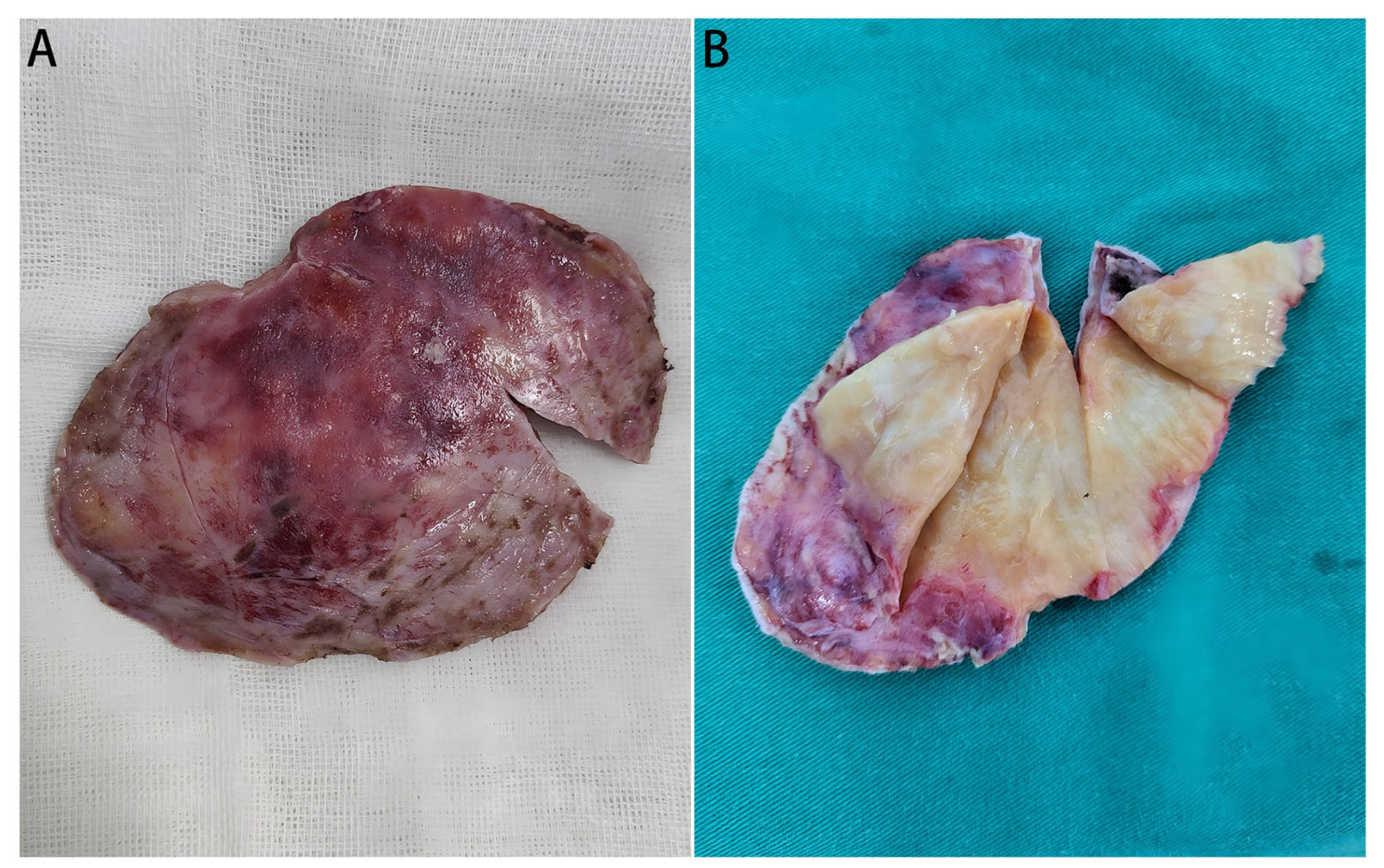 Diagnostics 16 00682 g003