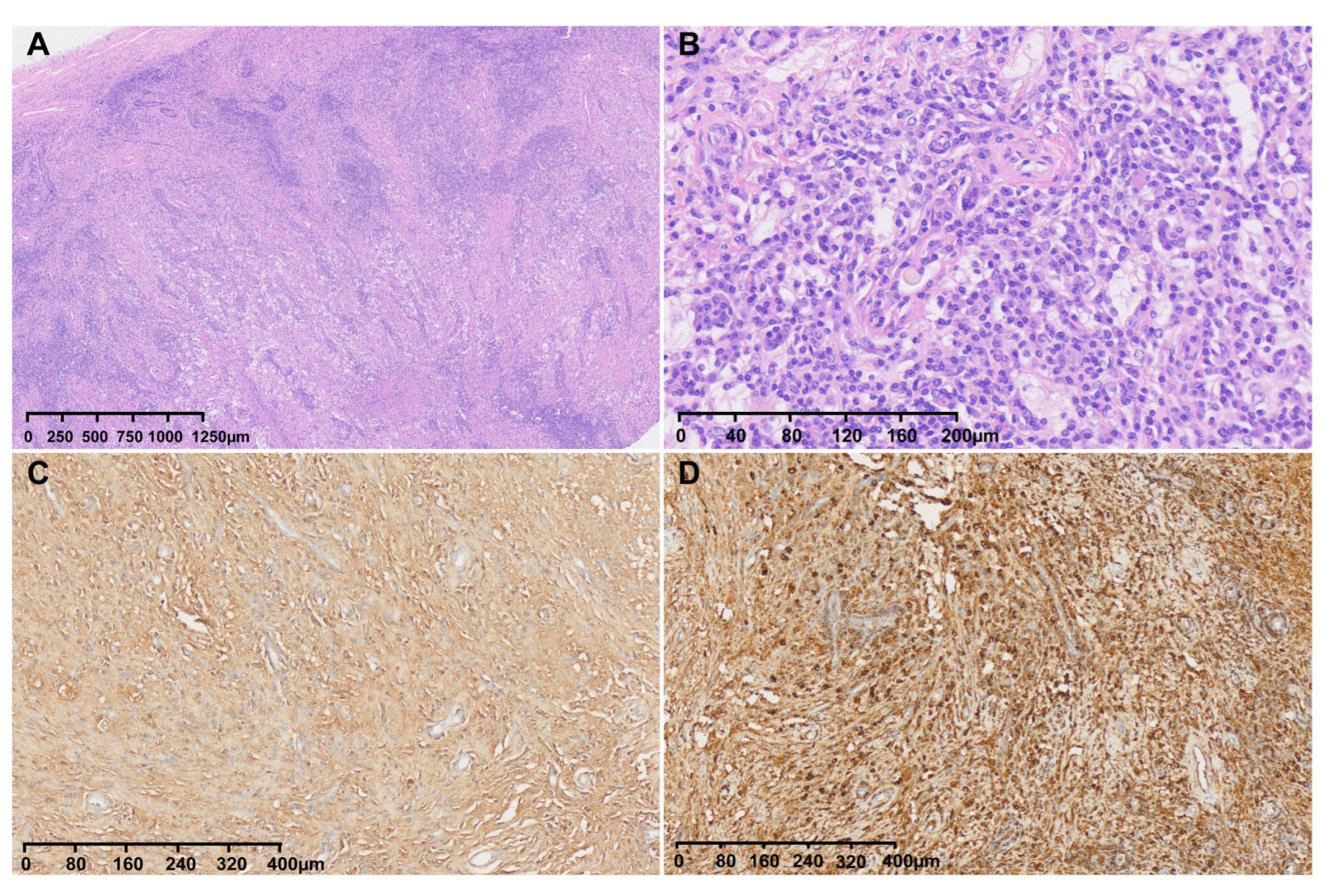 Diagnostics 16 00682 g004
