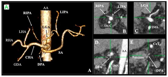Diagnostics 16 00701 g001