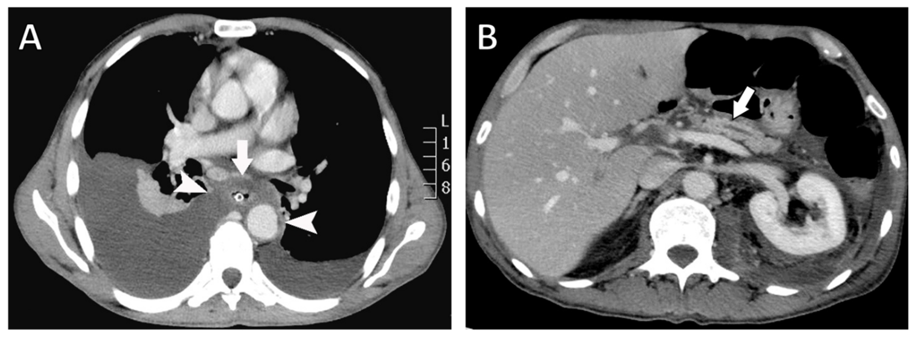 Diagnostics 16 00720 g002 Diagnostics 16 00720 g002