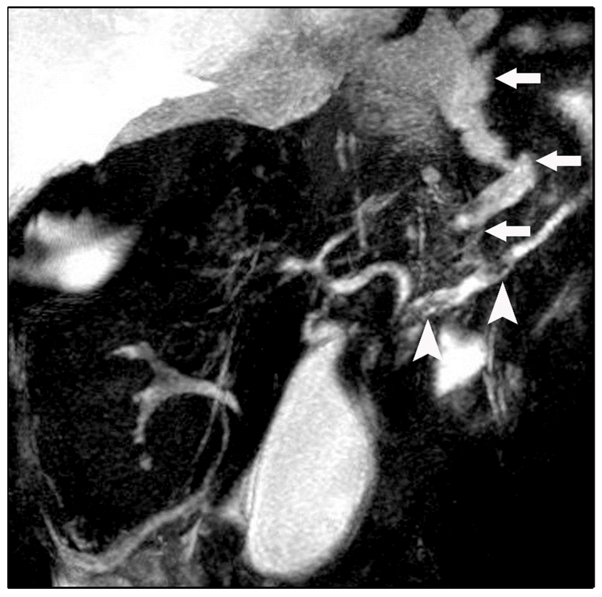 Diagnostics 16 00720 g003 Diagnostics 16 00720 g003