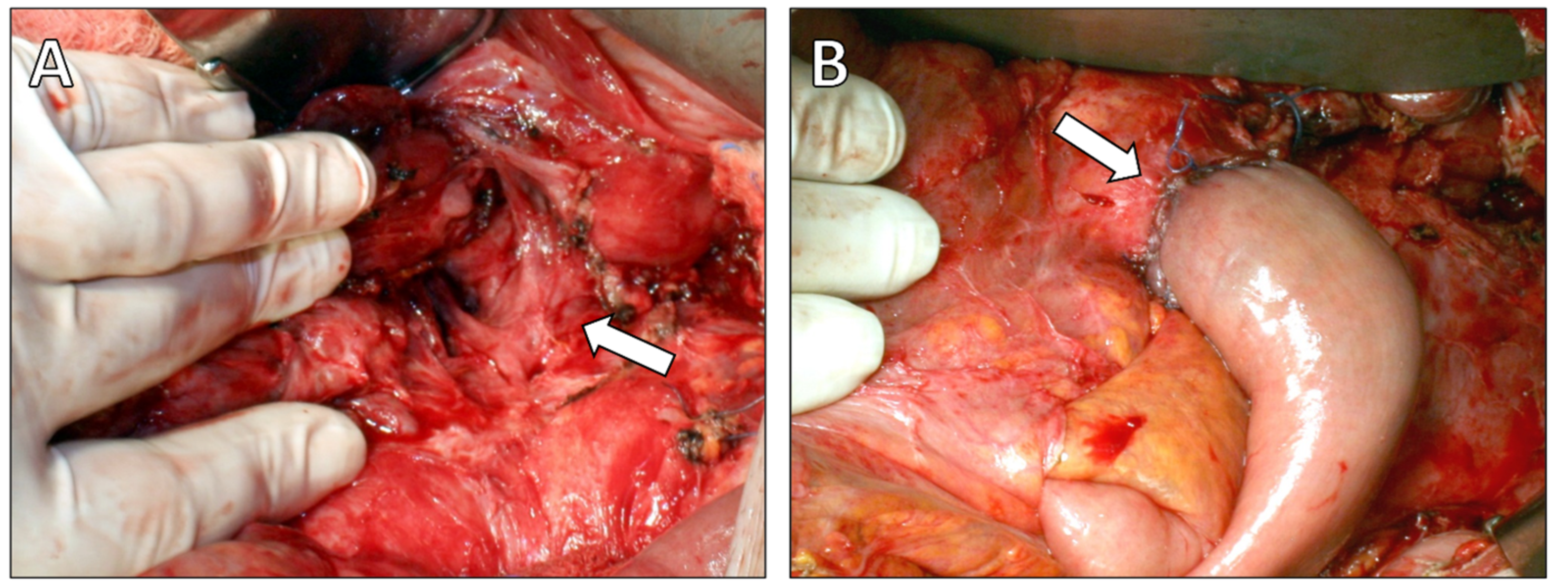 Diagnostics 16 00720 g004 Diagnostics 16 00720 g004