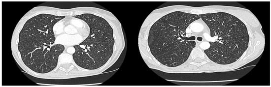 Diagnostics 16 00727 g003