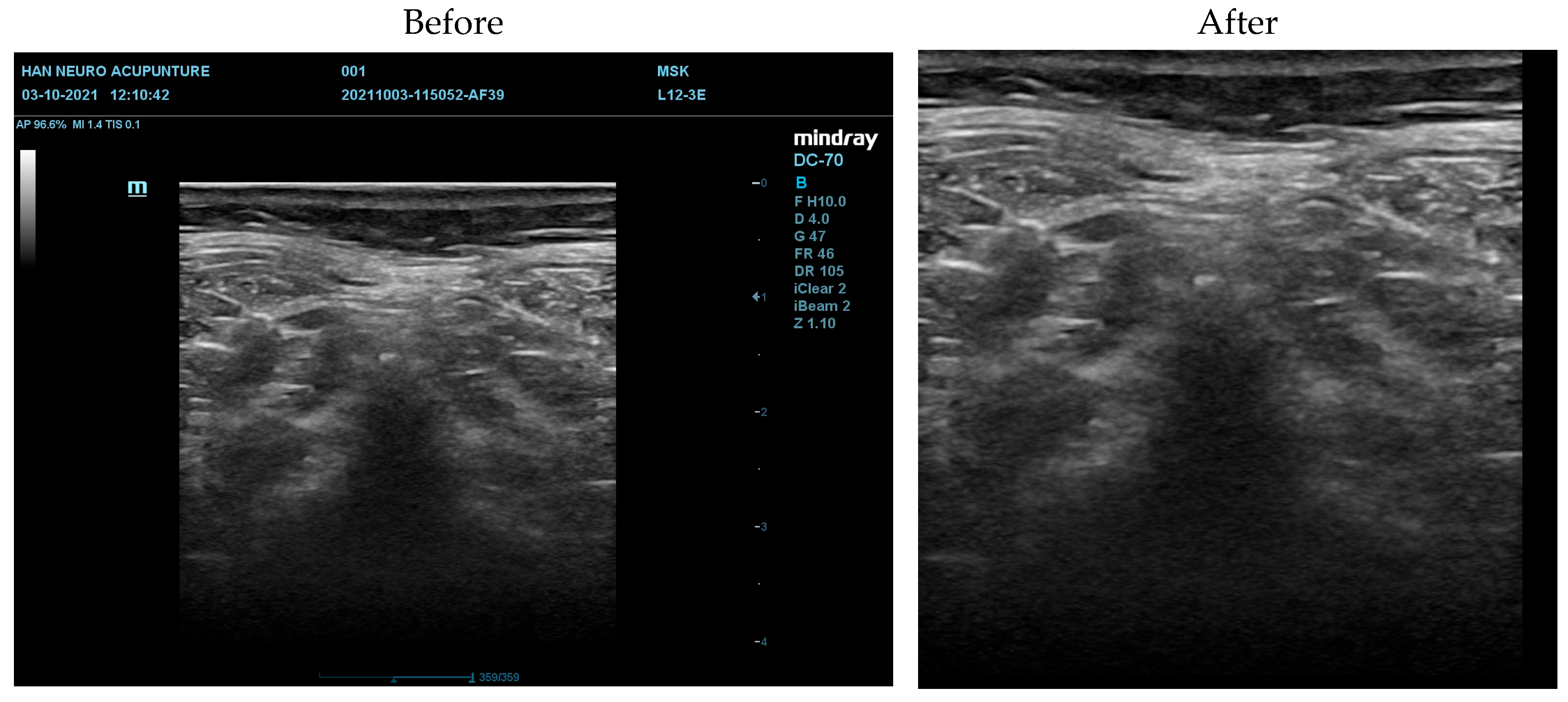 Diagnostics 16 00728 g003 Diagnostics 16 00728 g003