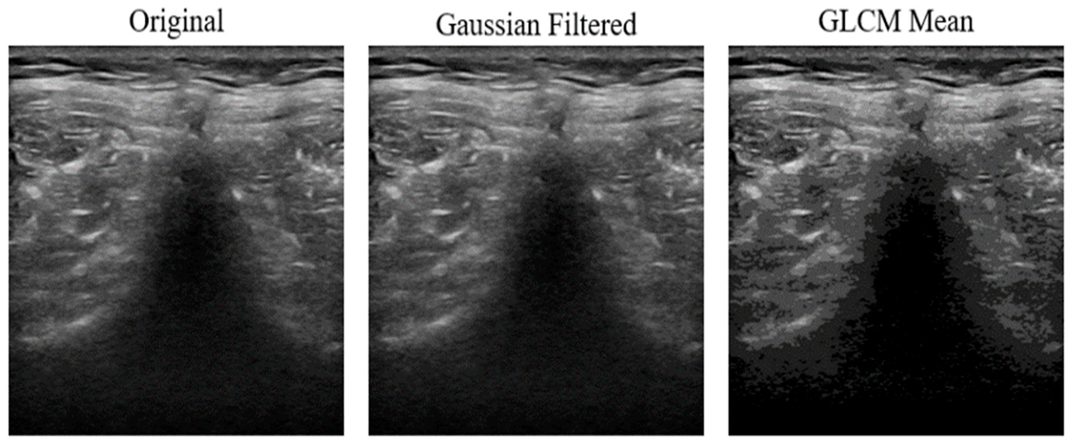 Diagnostics 16 00728 g005 Diagnostics 16 00728 g005