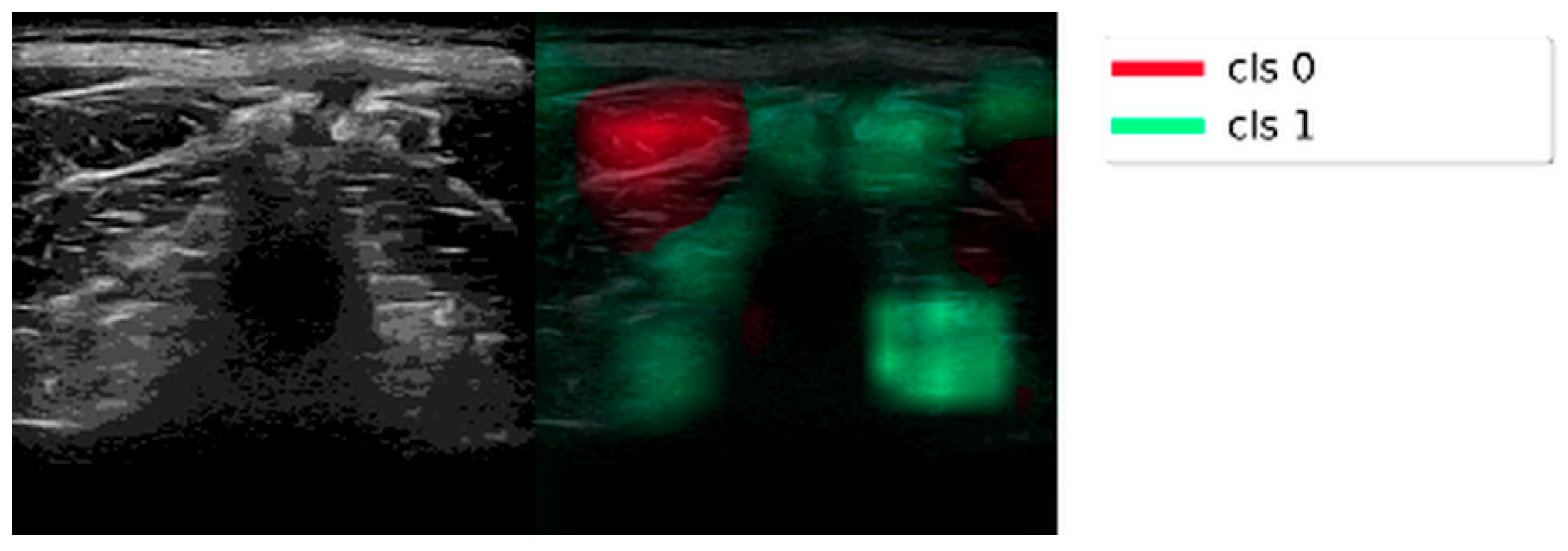 Diagnostics 16 00728 g008 Diagnostics 16 00728 g008