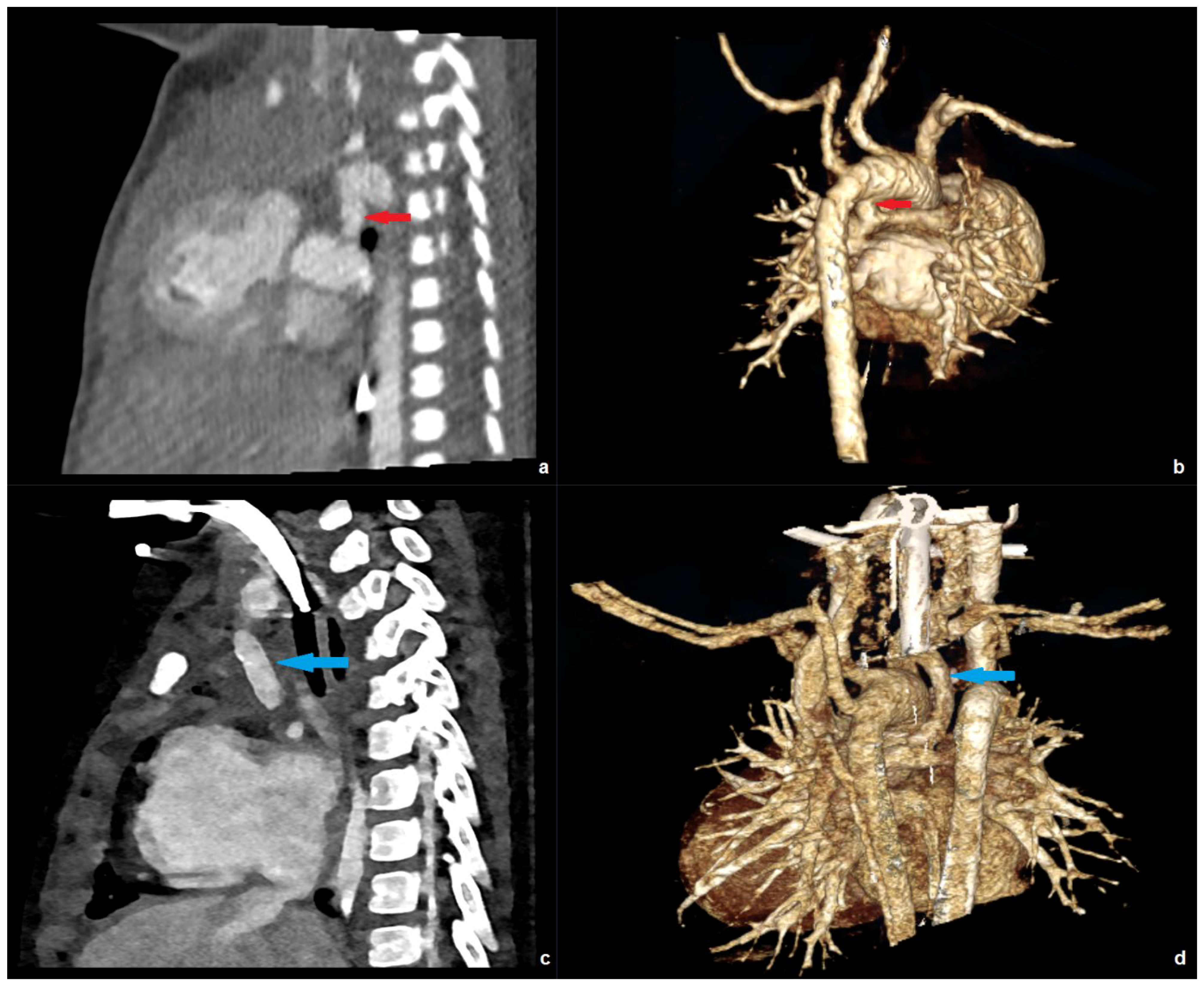 Diagnostics 16 00735 g005