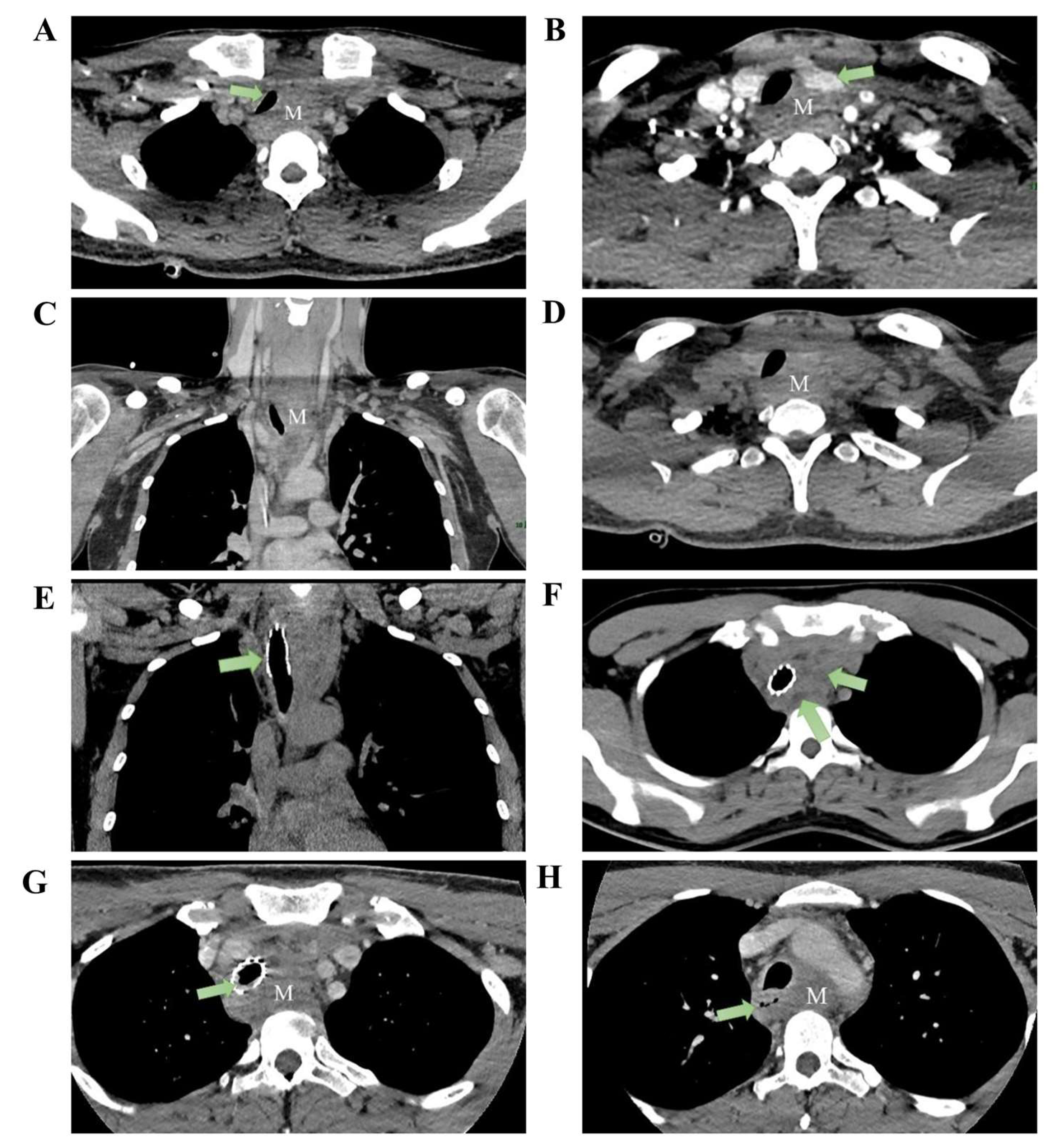 Diagnostics 16 00797 g001