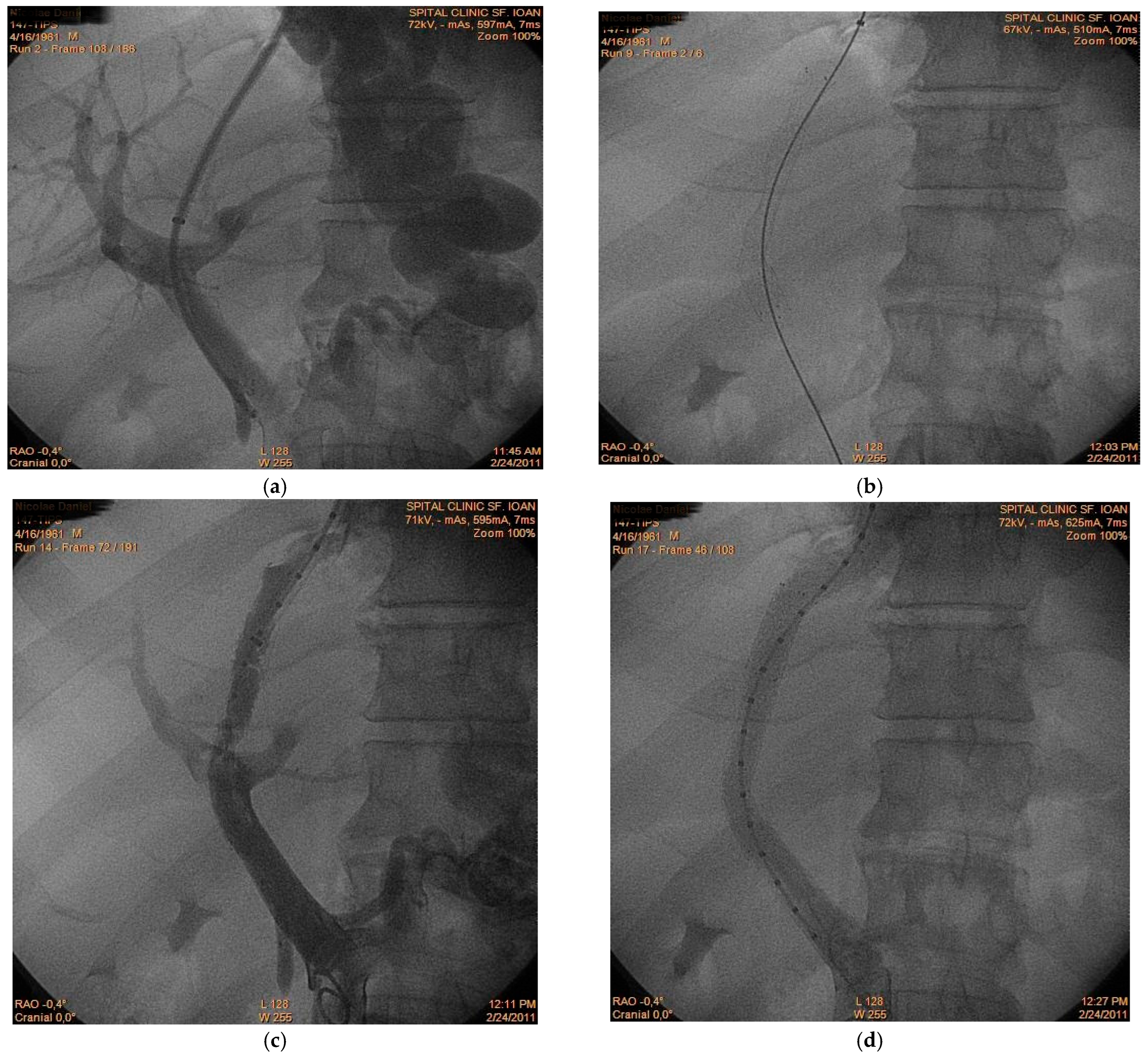 Diagnostics 16 00800 g001